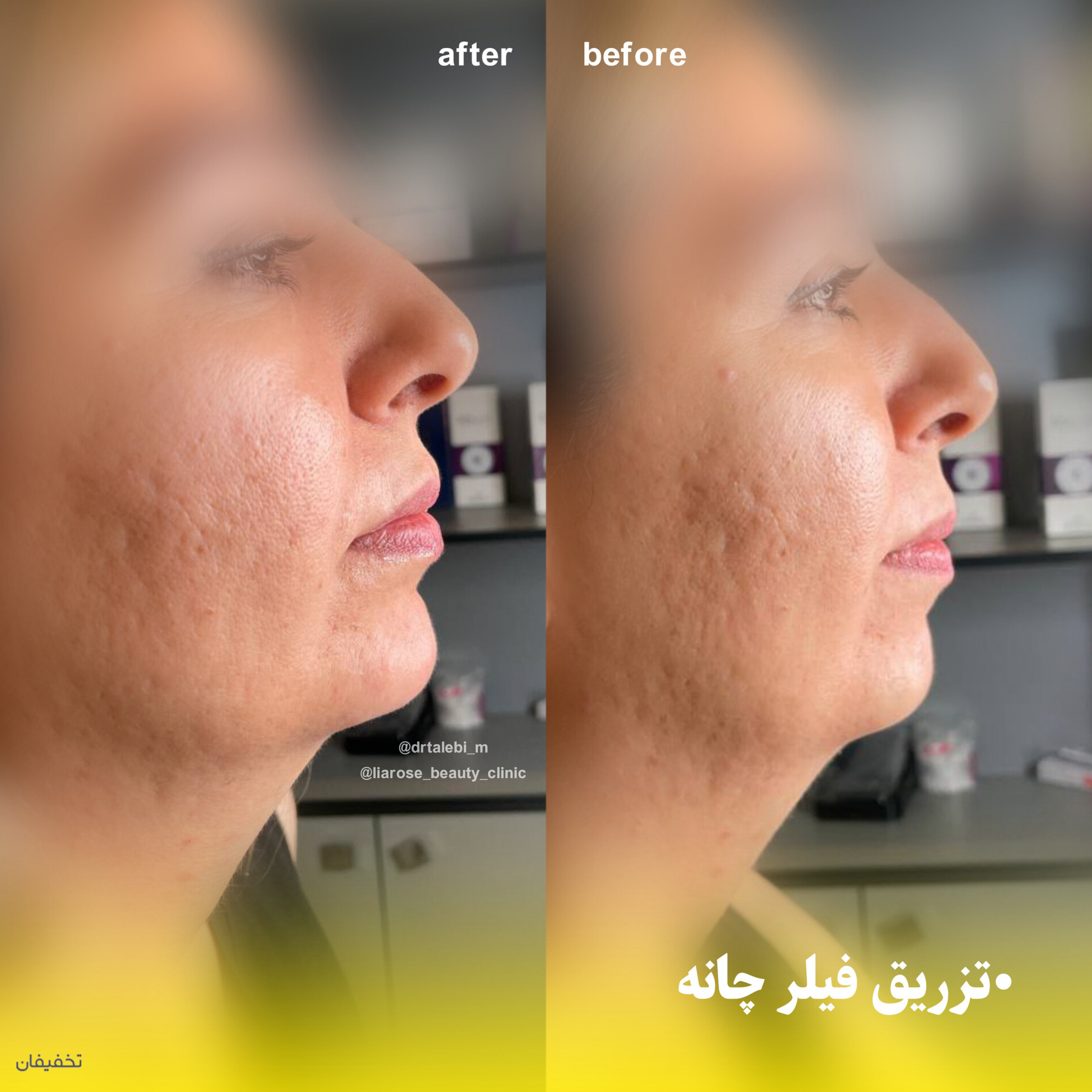 مرکز پوست و زیبایی لیارز