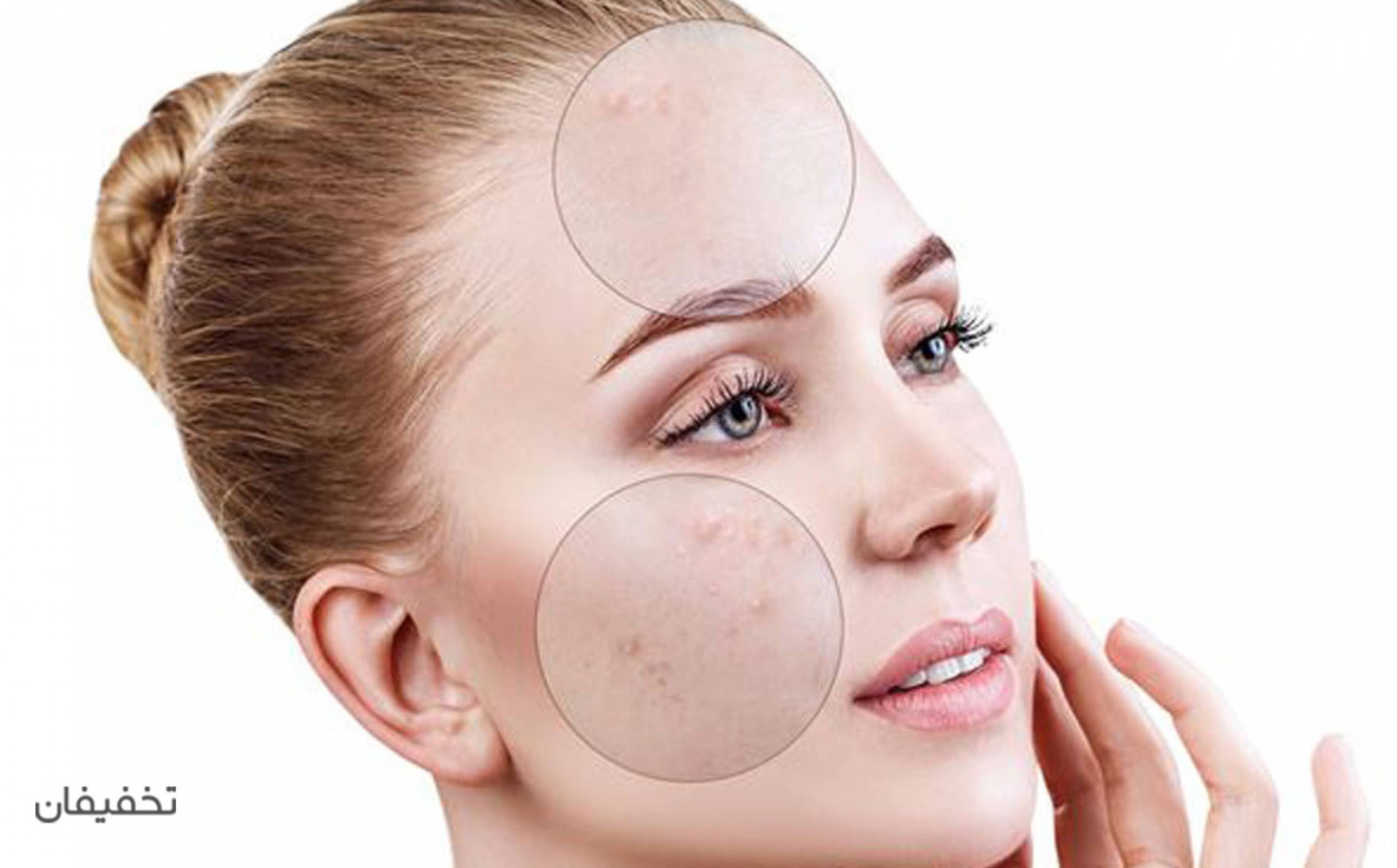 مرکز پوست ریدینت