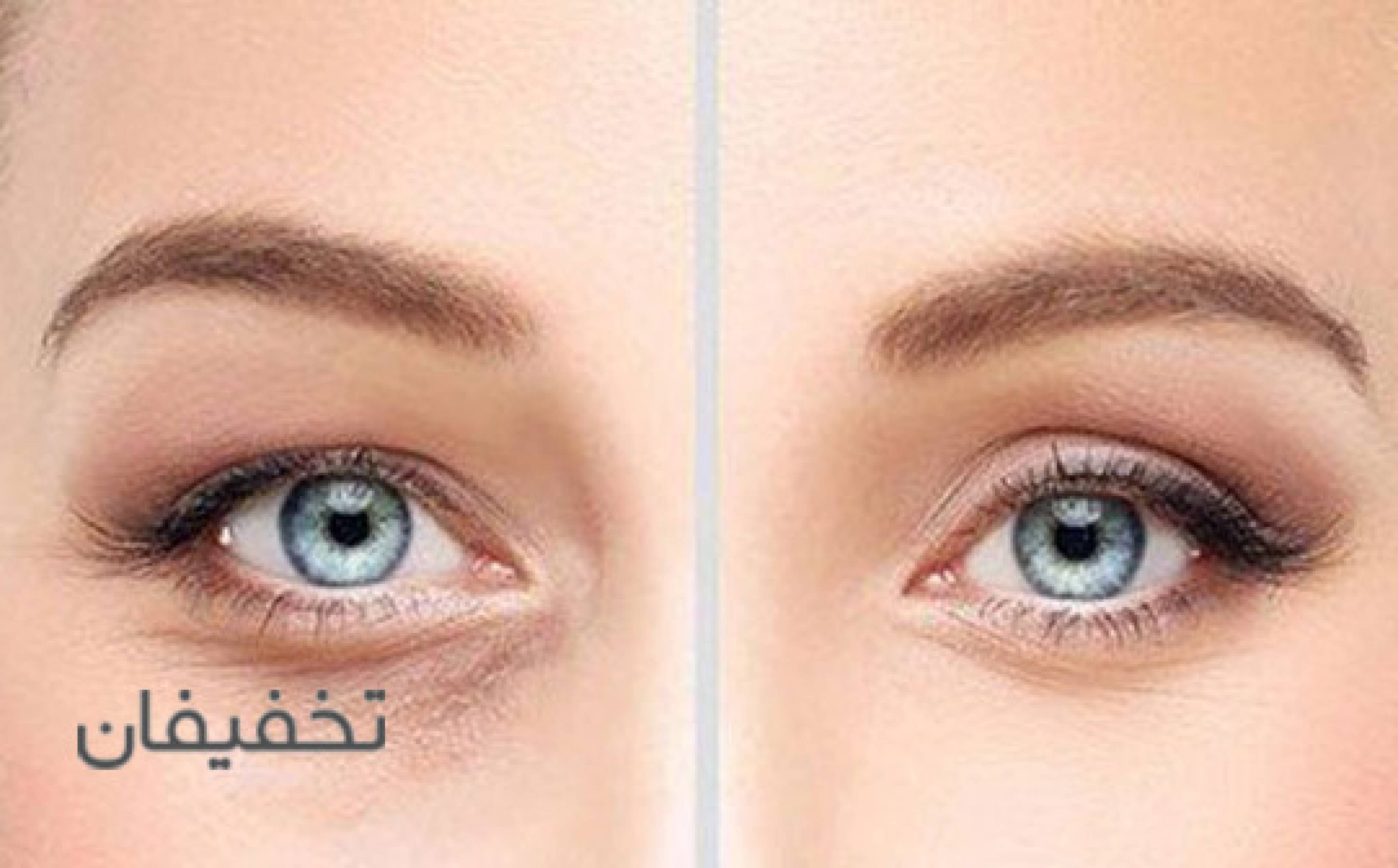 مطب دکتر علی محمودی