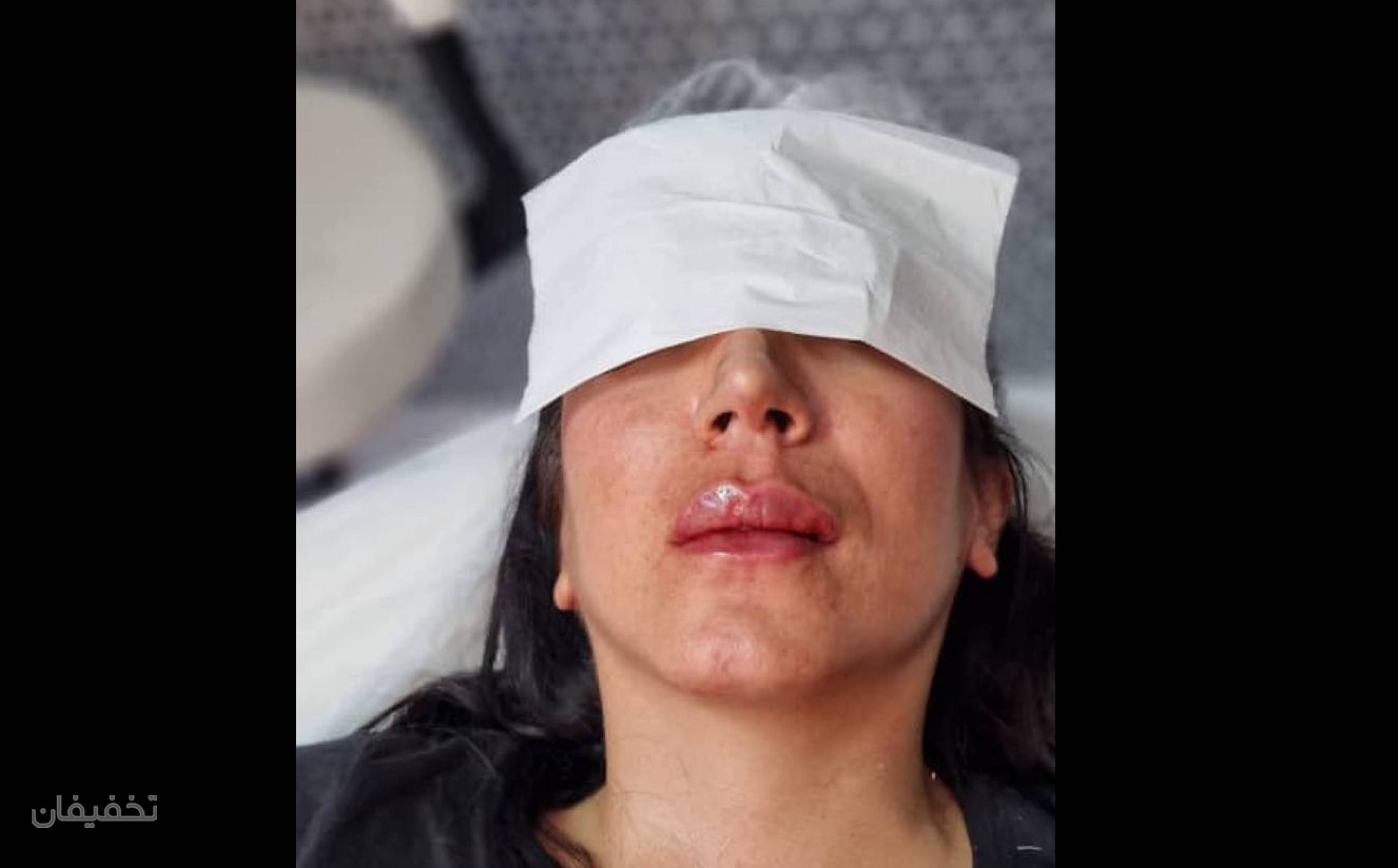 مرکز پوست مو و زیبایی حس