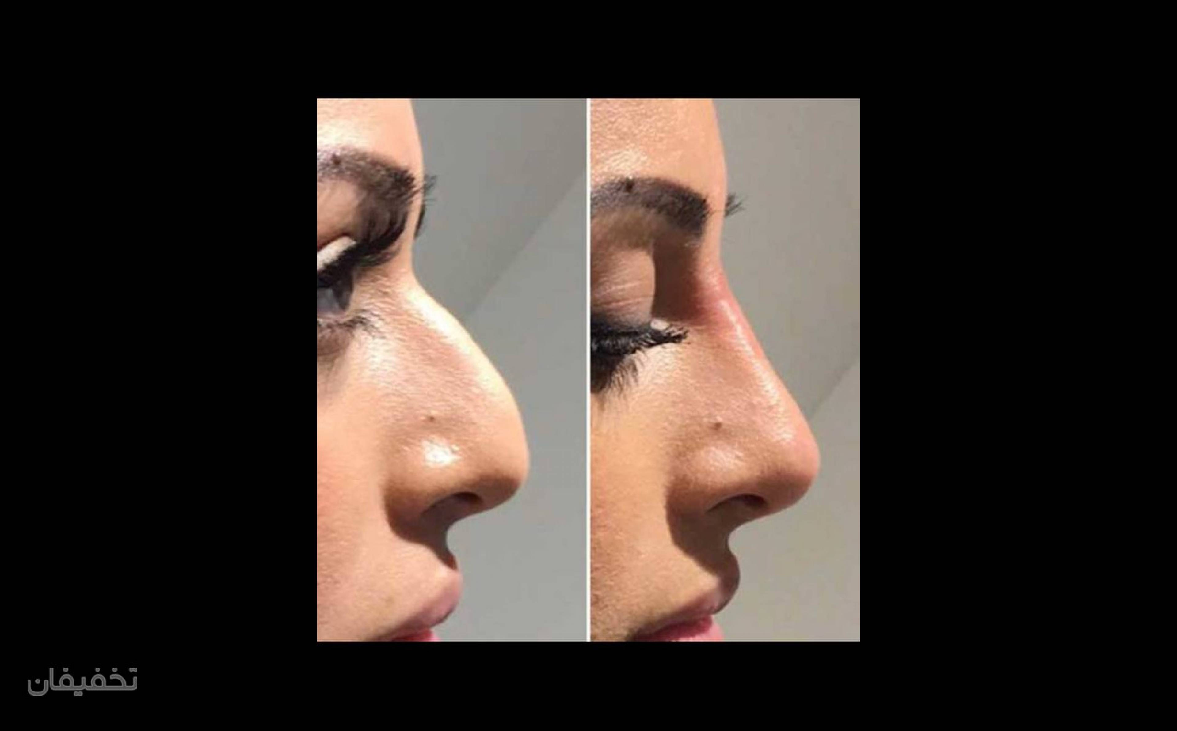 مرکز پوست مو و زیبایی حس
