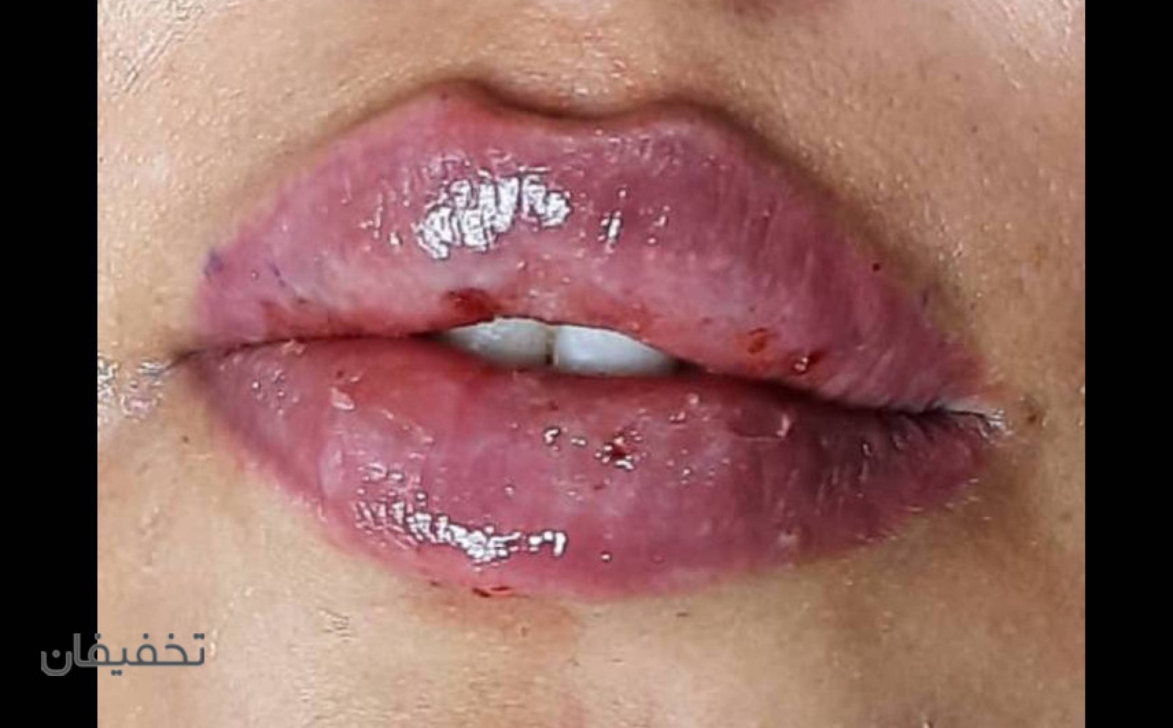 مرکز پوست مو و زیبایی حس