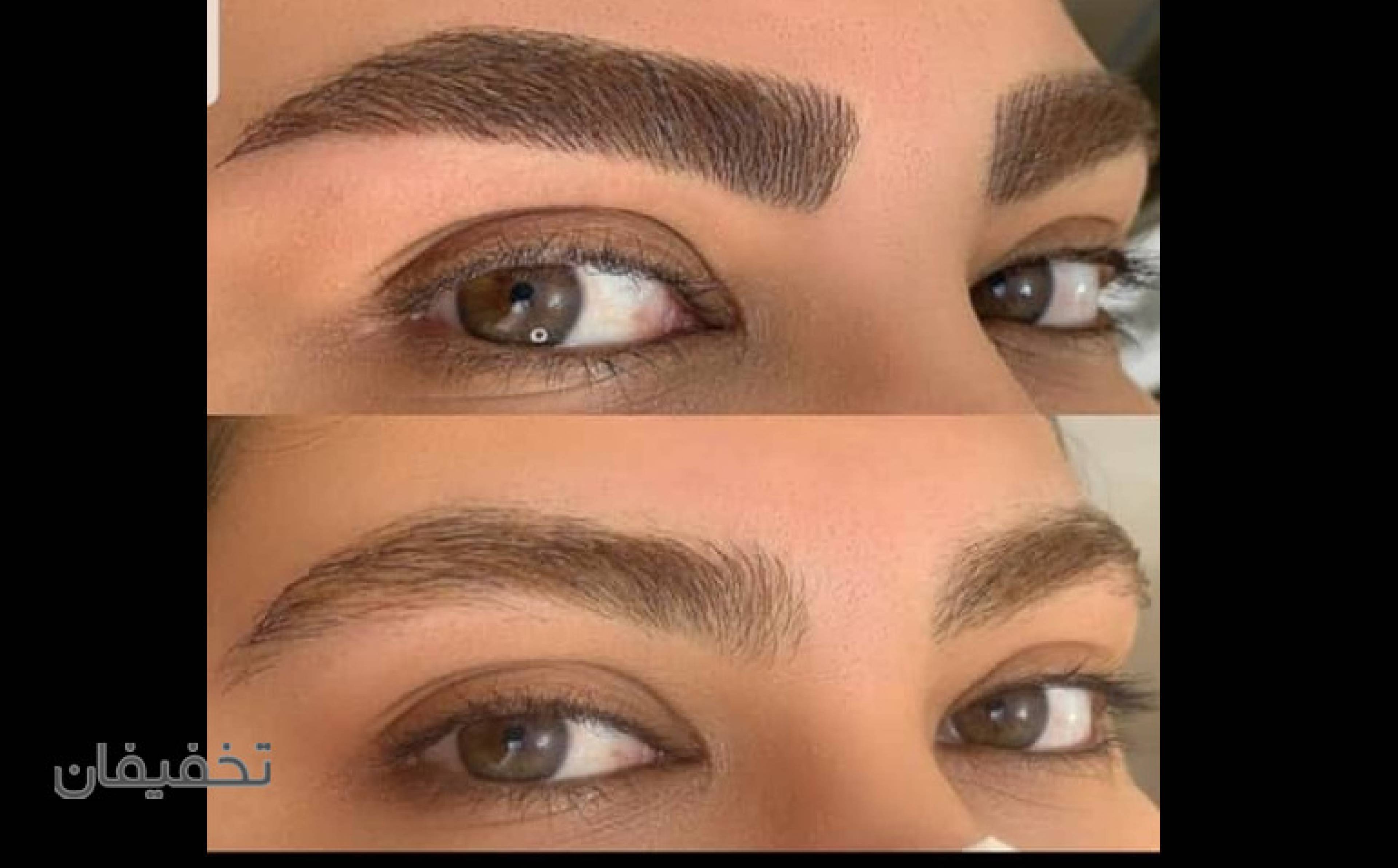 میکروبلیدینگ ابرو و فیبروز نیلوفر