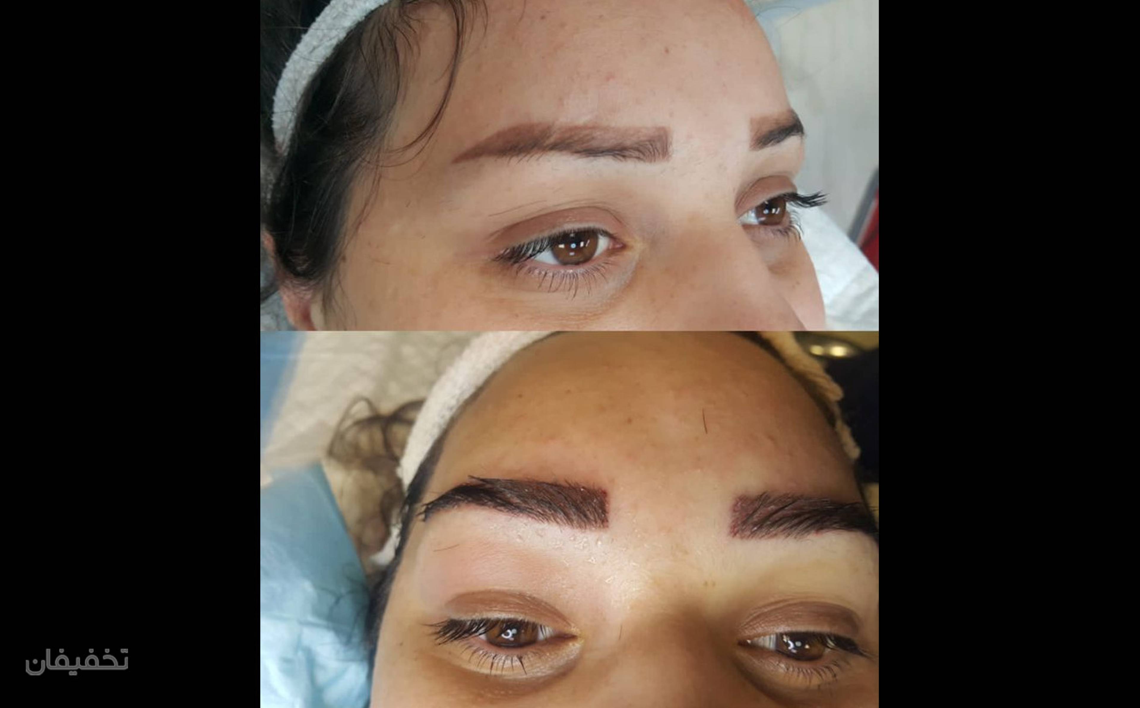 کیلینیک فوق تخصصی کاشت مو و کاشت ابروی سان شیدا