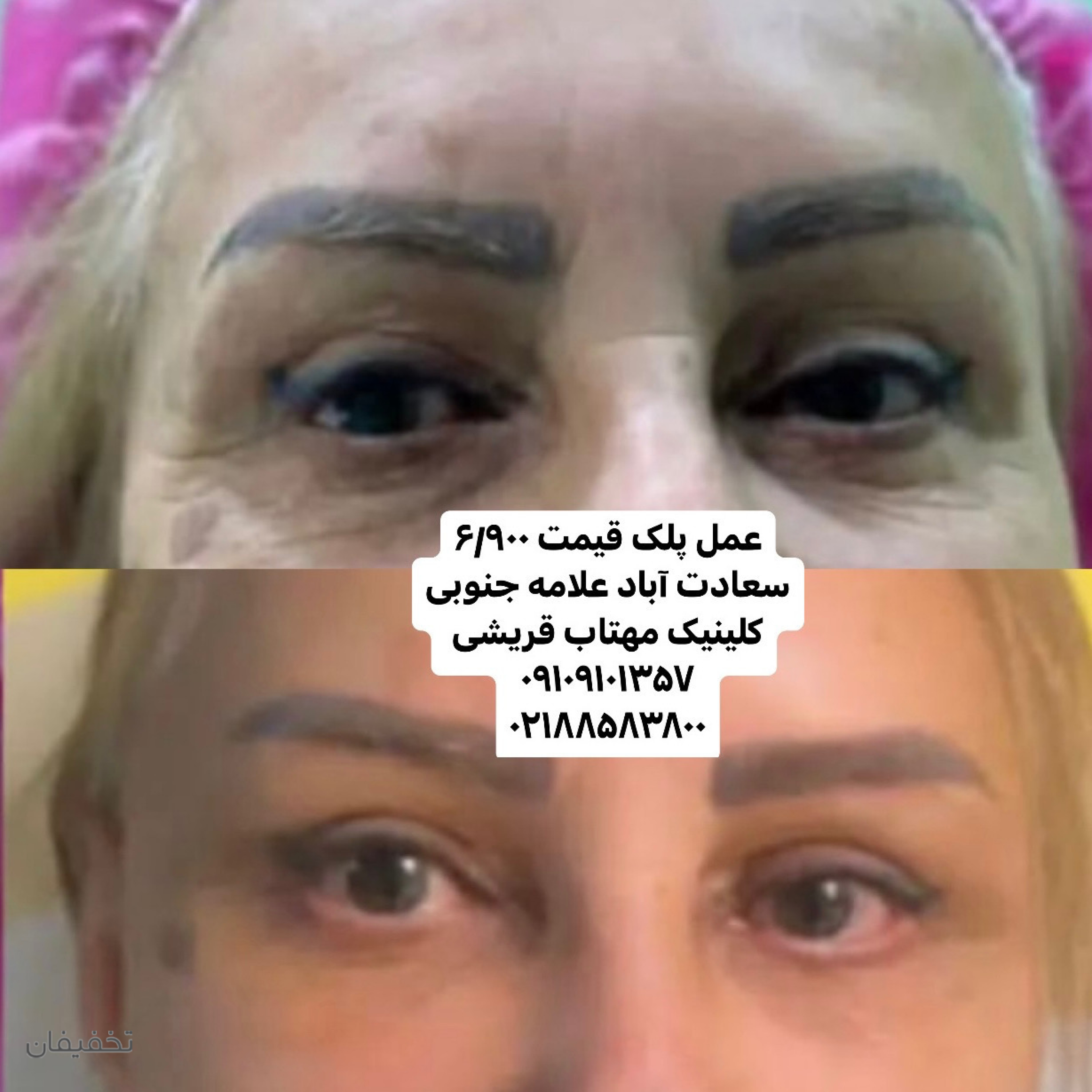 مرکز لیزر الکس و پوست مهتاب قریشی