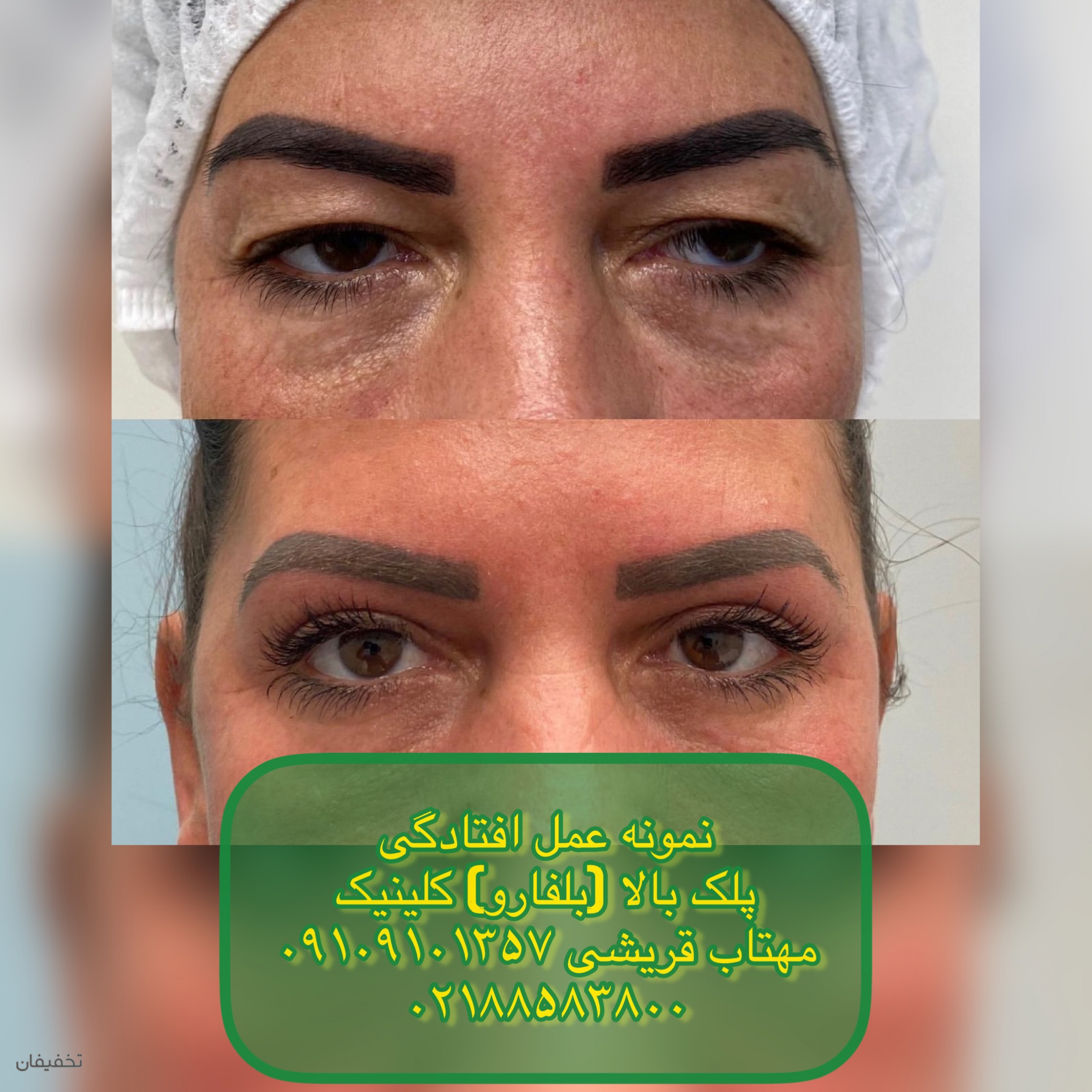 مرکز لیزر الکس و پوست مهتاب قریشی