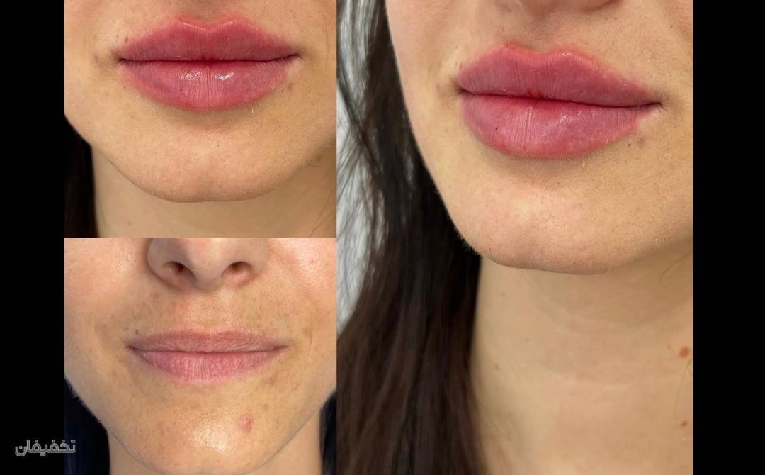 مرکز لیزر الکس و پوست مهتاب قریشی