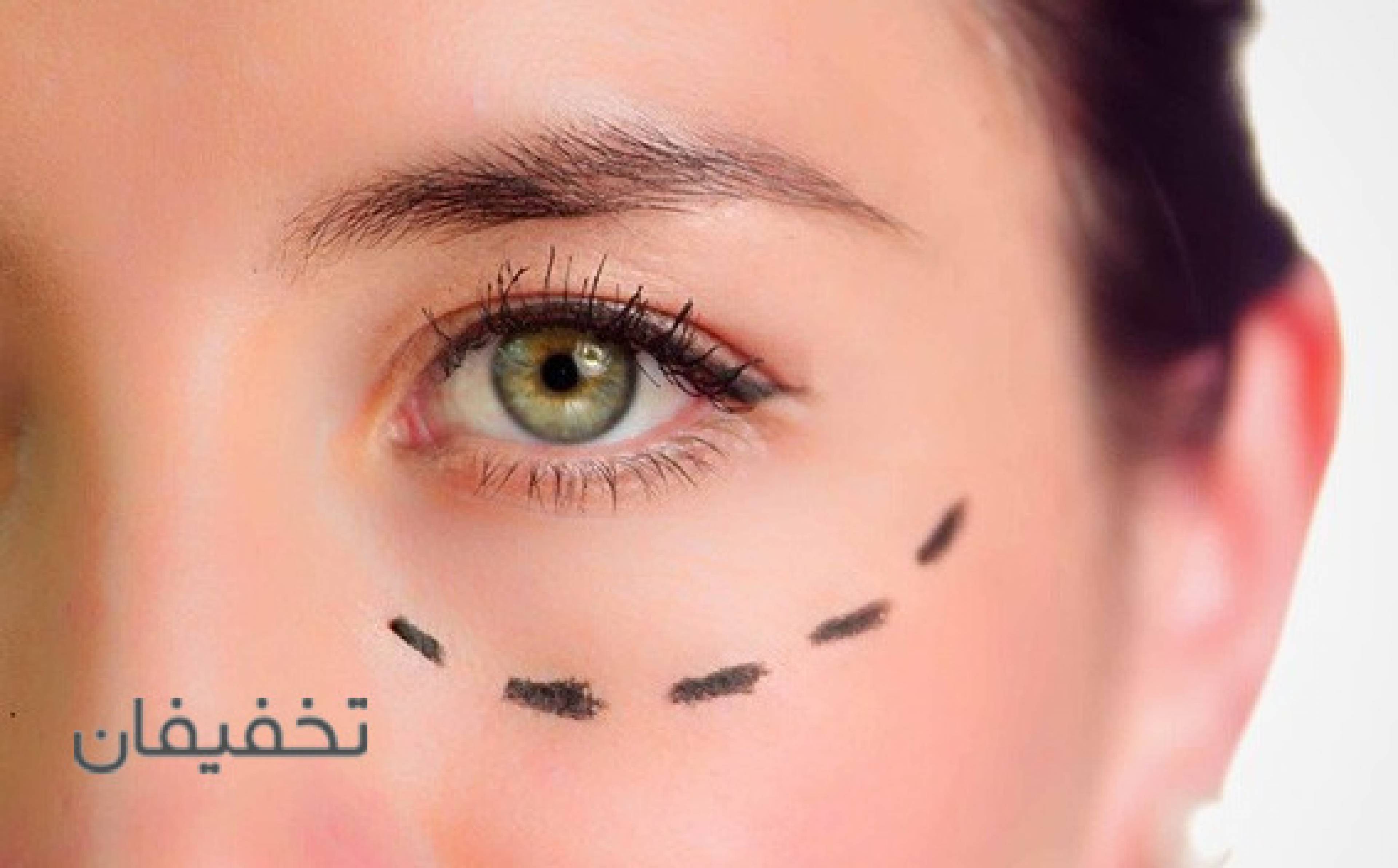 مطب دکتر احمدی بادی