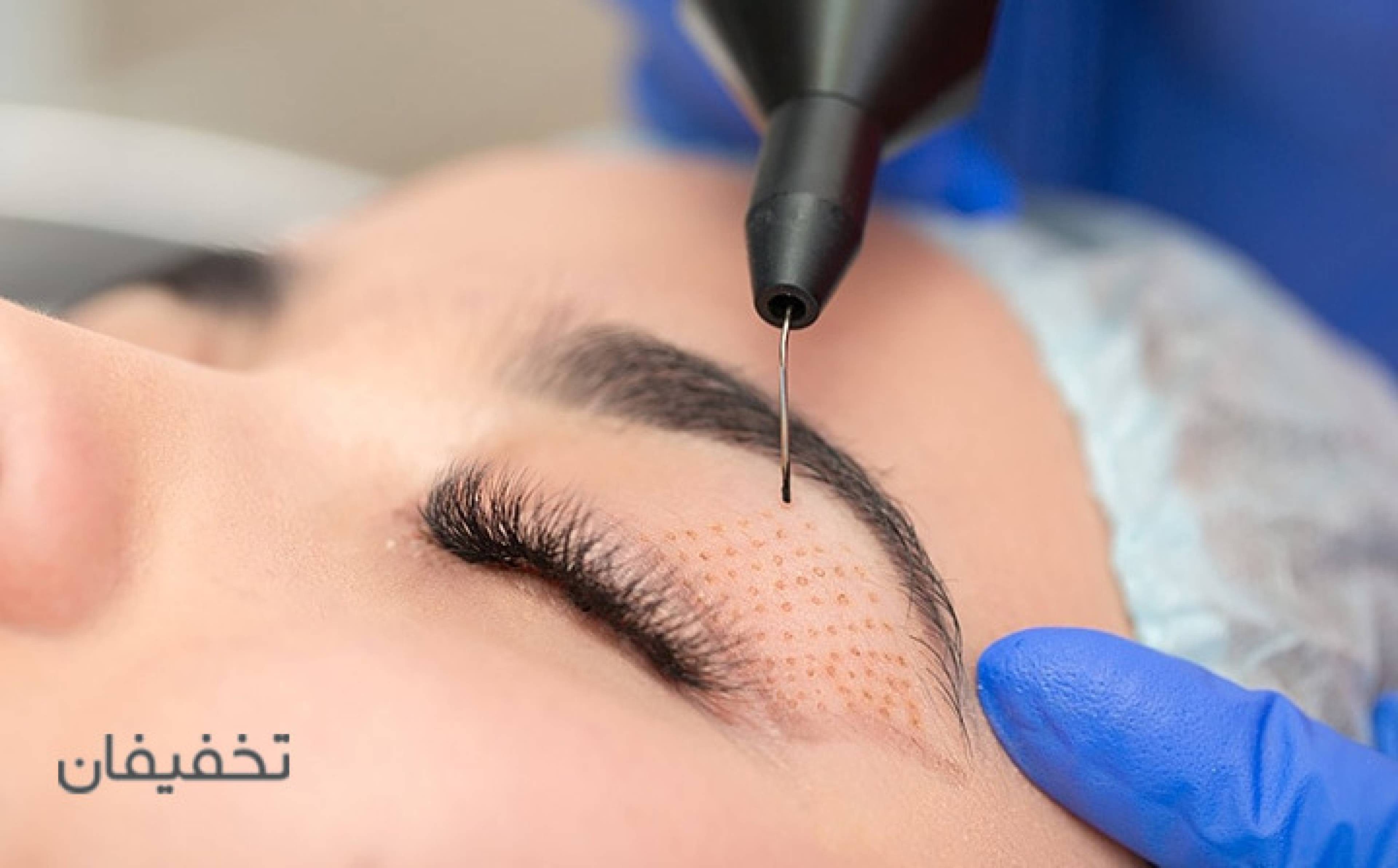 مطب دکتر احمدی بادی