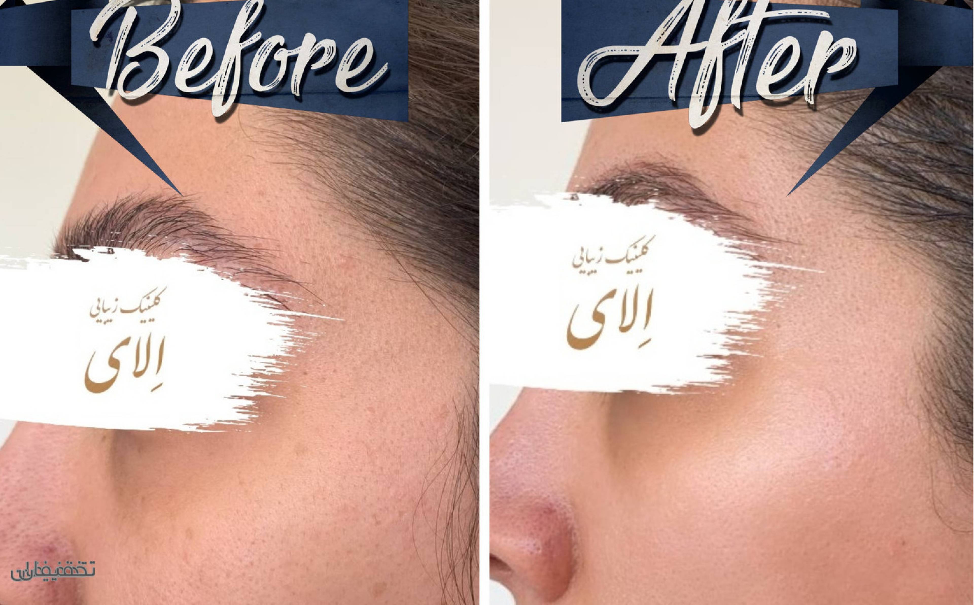 کلینیک زیبایی الای