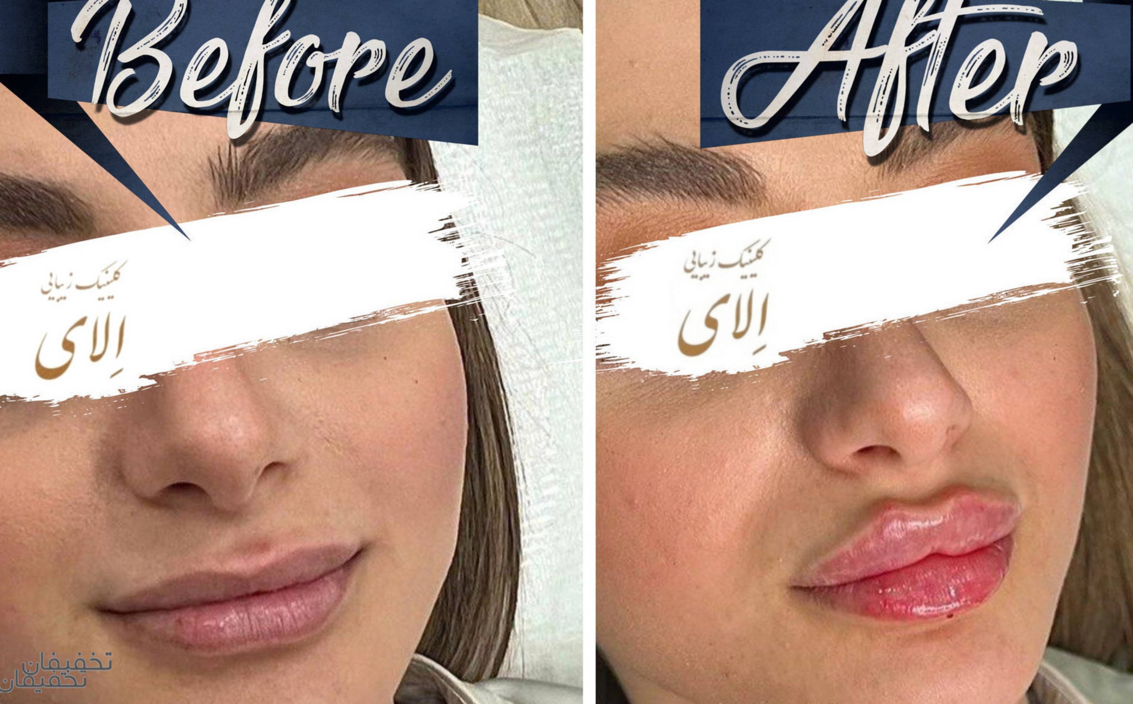 کلینیک زیبایی الای
