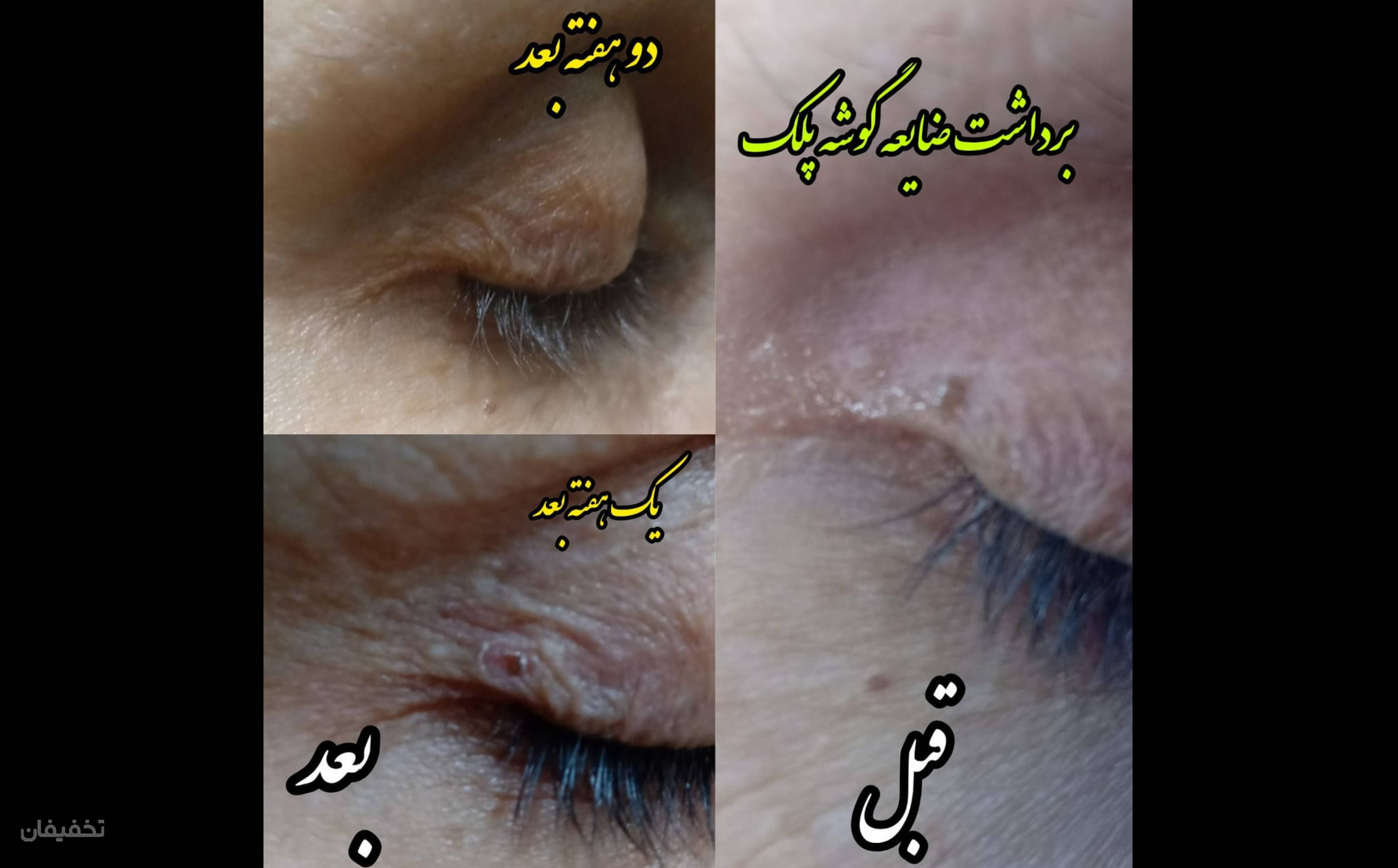 سالن زیبایی کمند