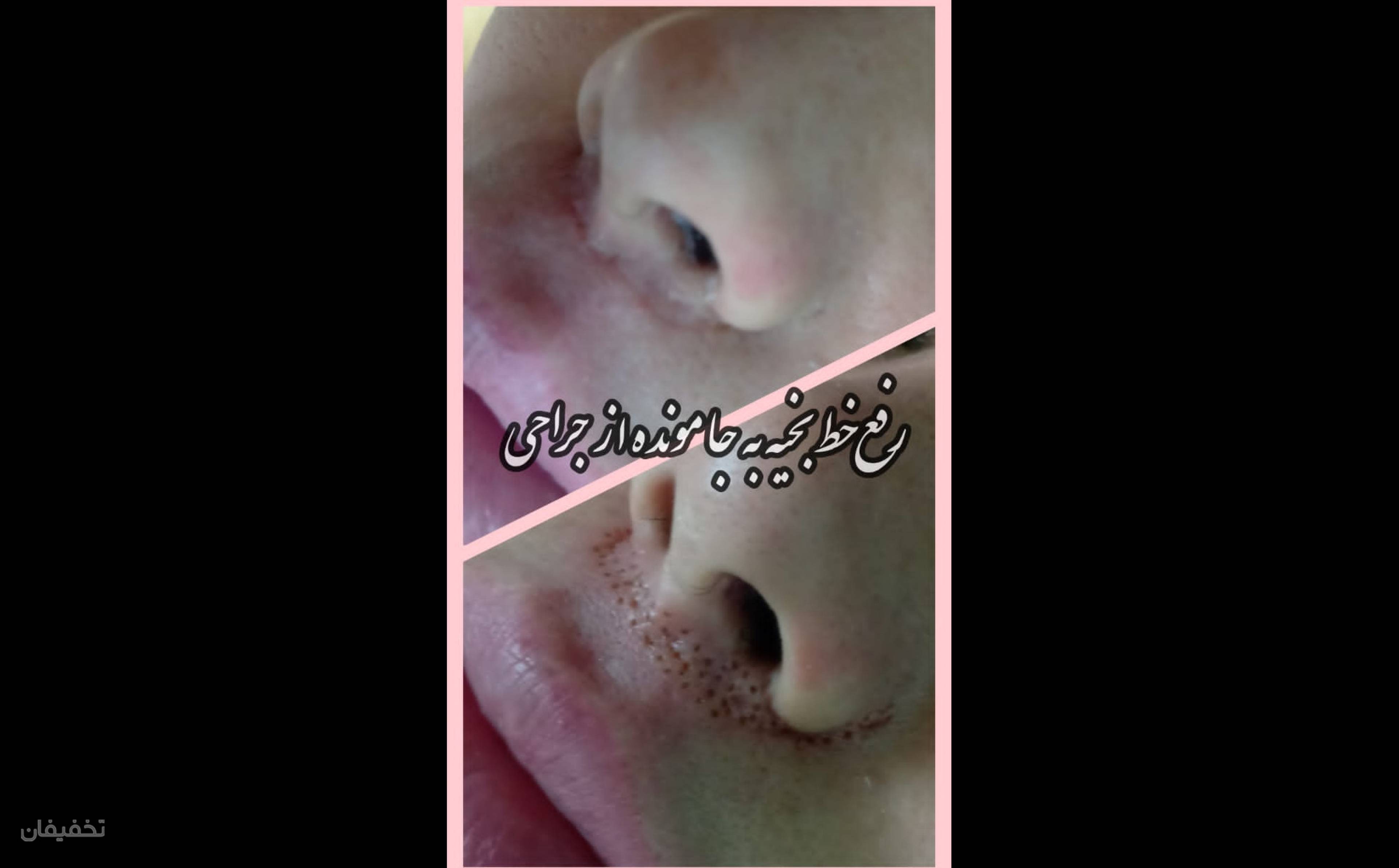 سالن زیبایی کمند