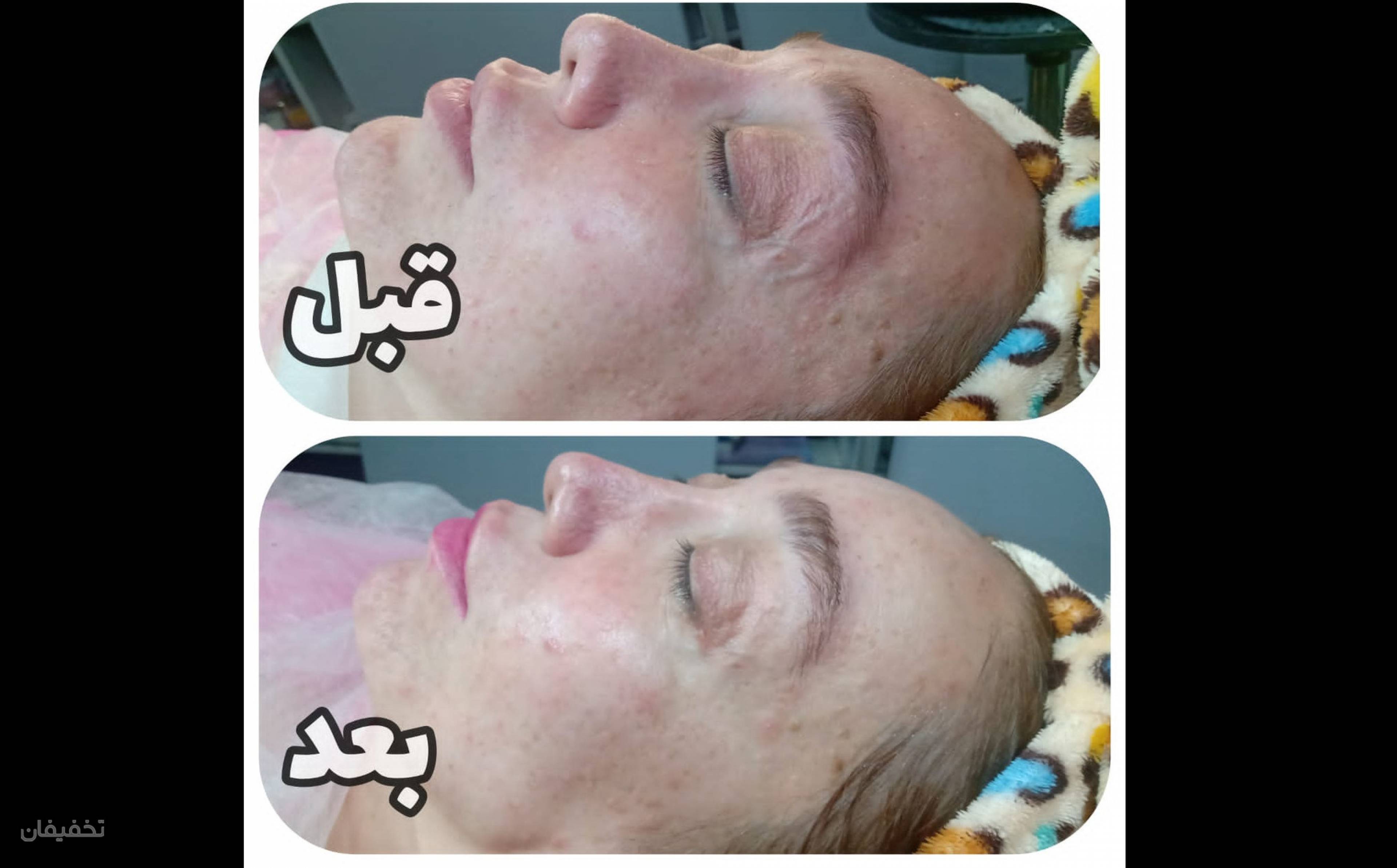 سالن زیبایی کمند
