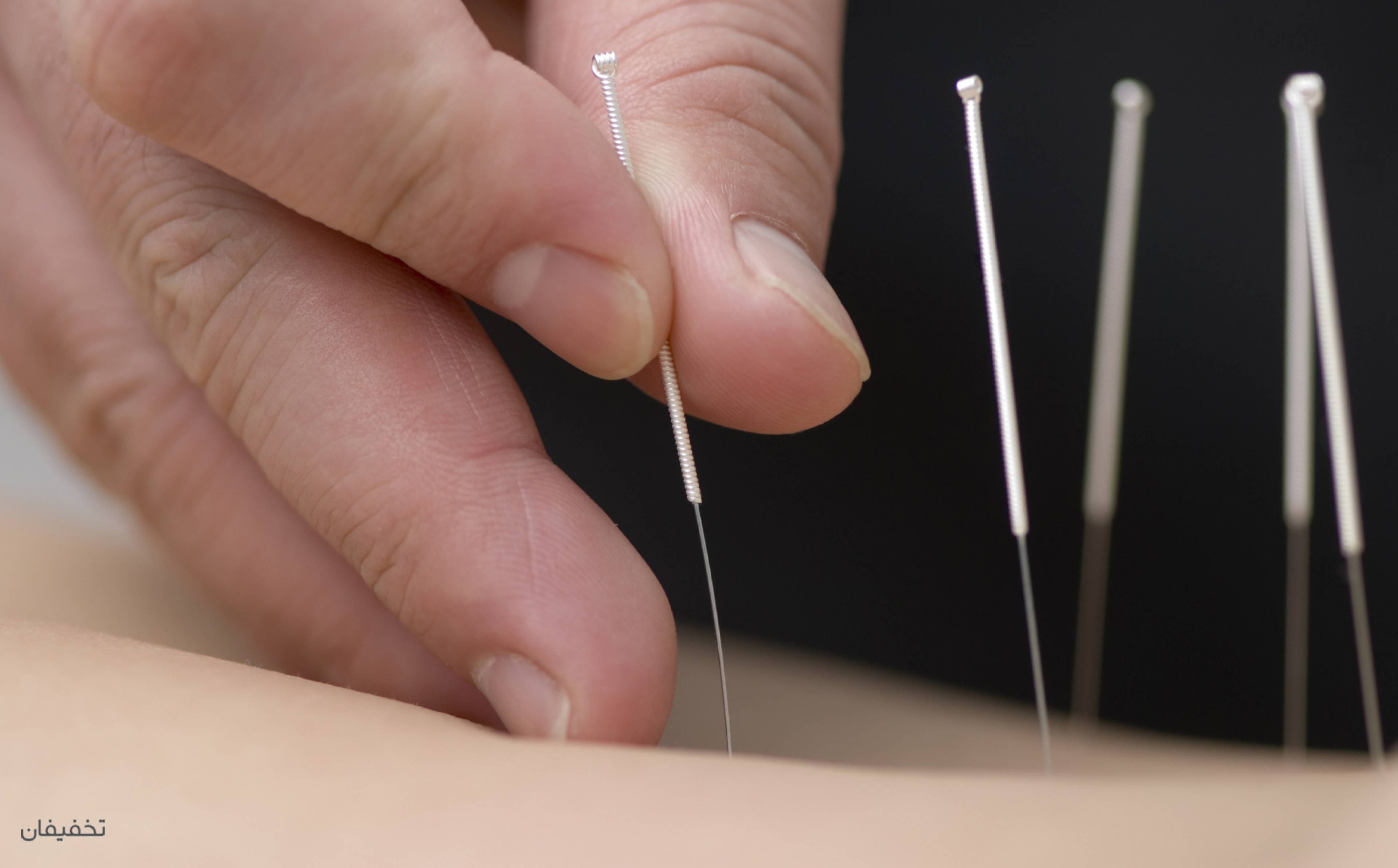 مطب طب سوزنی دکتر وحید قاسمی(شعبه پیروزی)