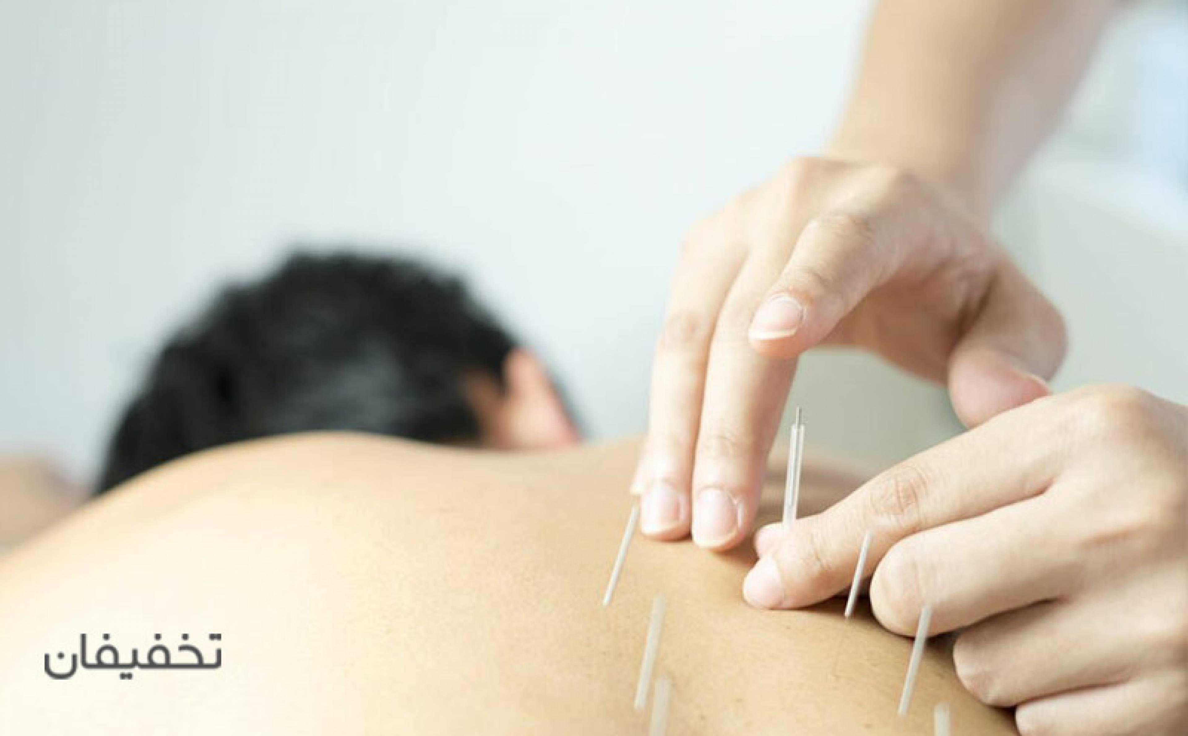 مطب طب سوزنی دکتر وحید قاسمی(شعبه پیروزی)