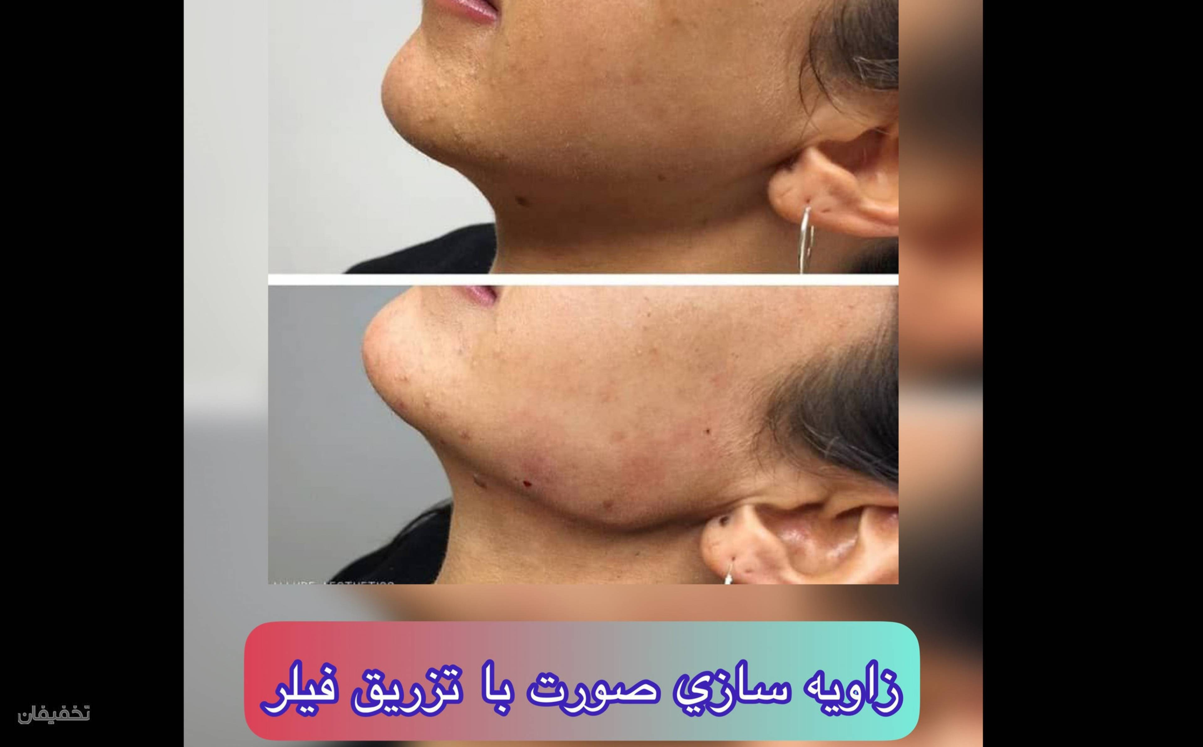 مجموعه ليزر و زيبايي دِلين