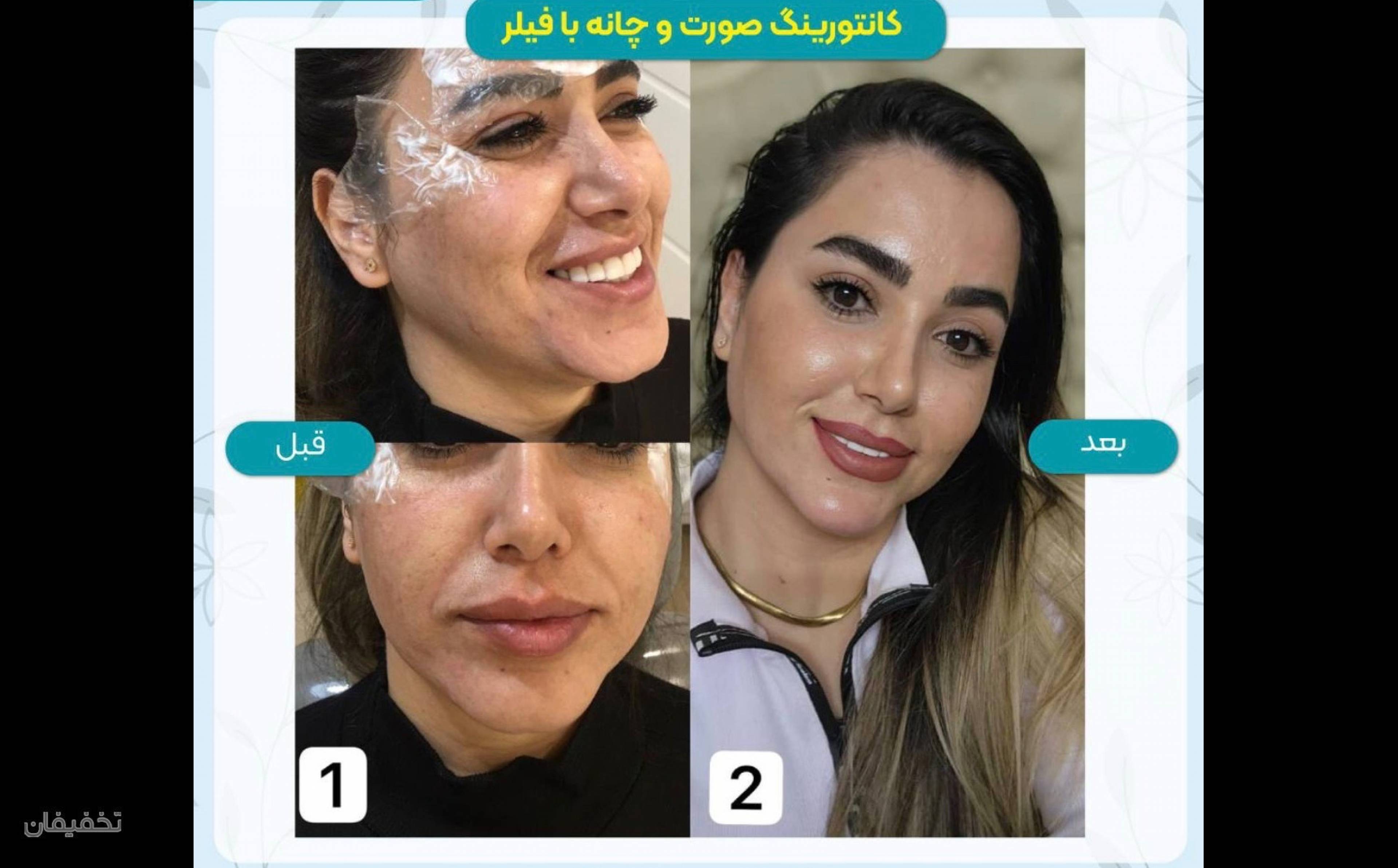 مجموعه ليزر و زيبايي دِلين
