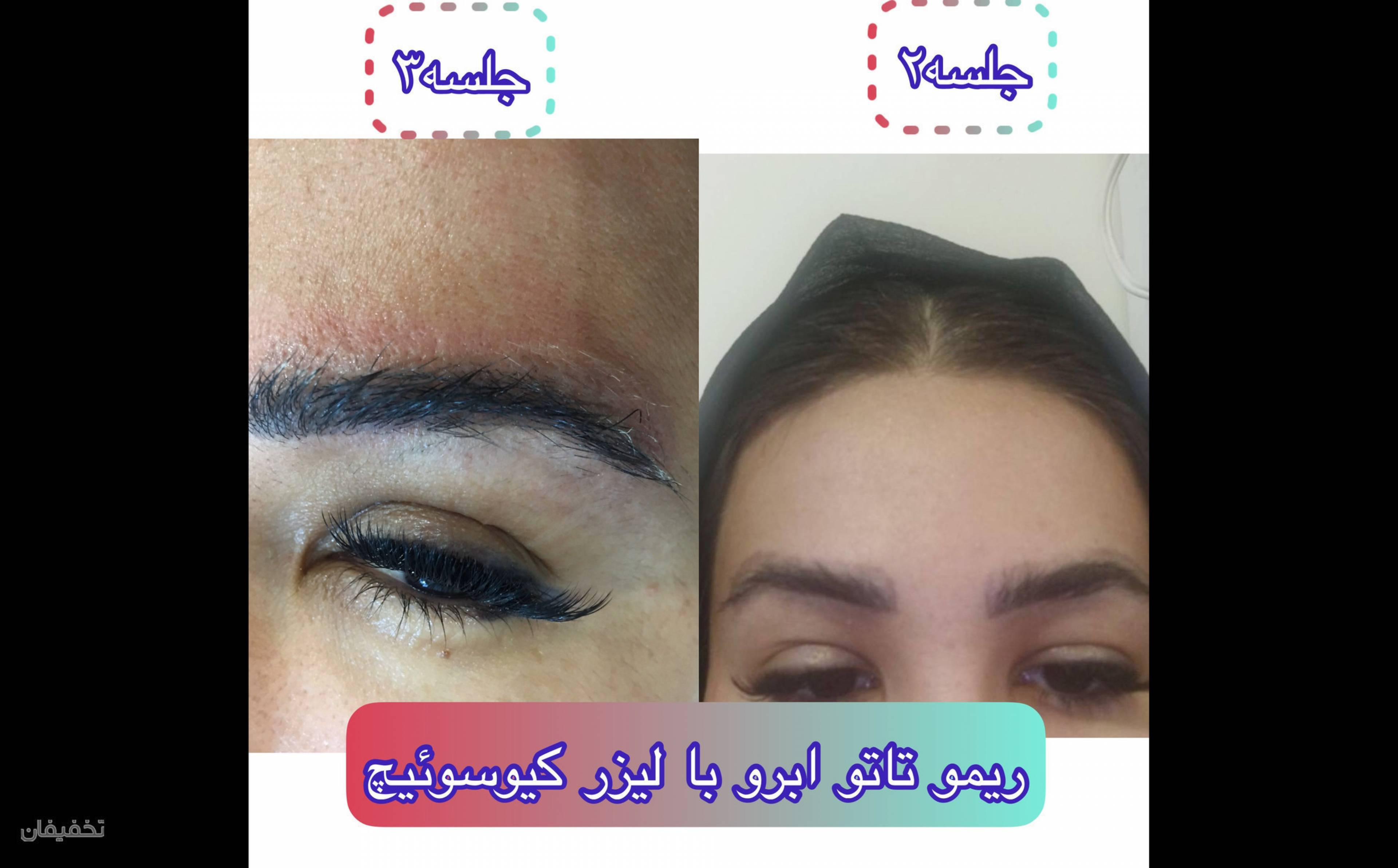 مجموعه ليزر و زيبايي دِلين