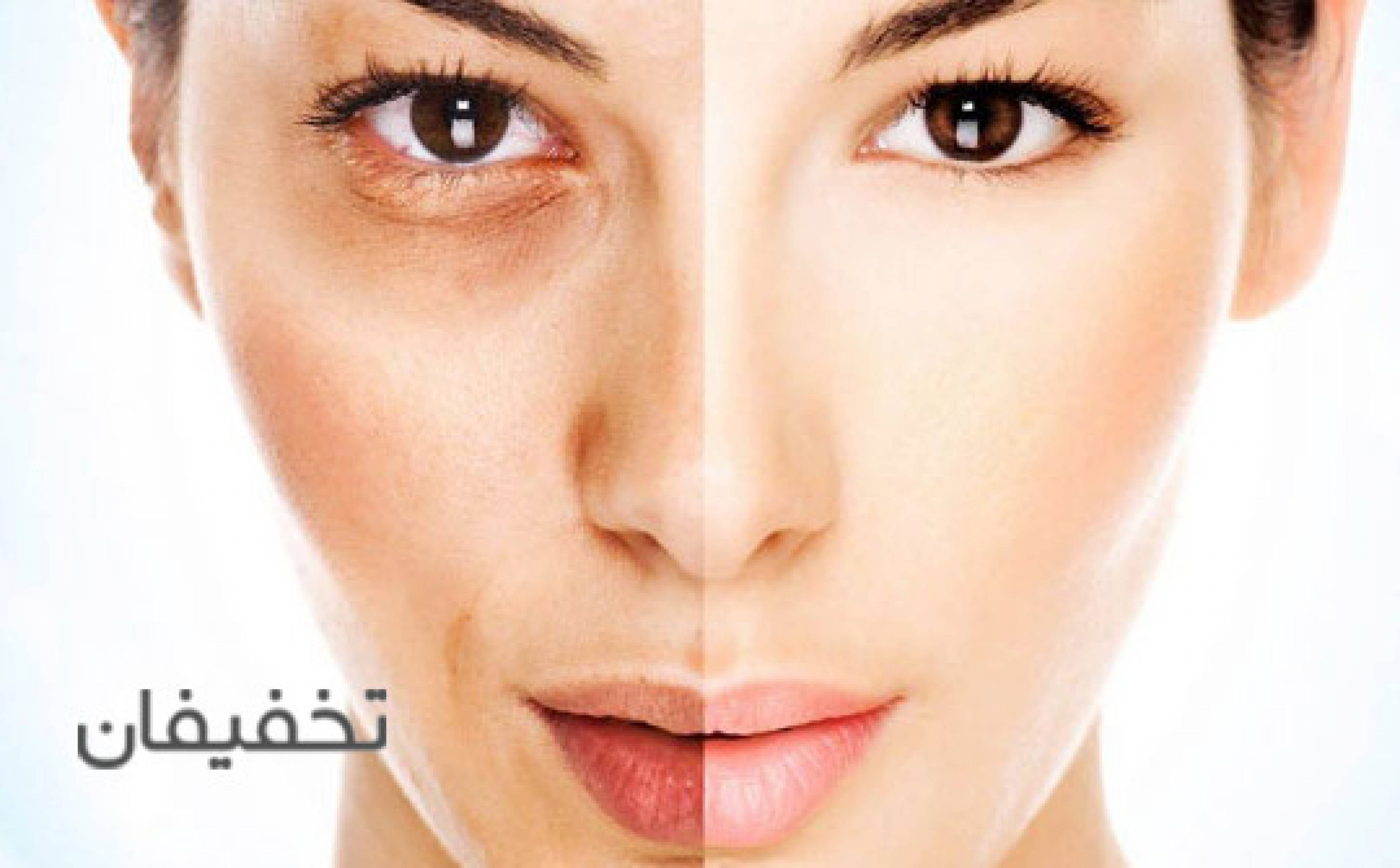 مطب لاغری زنان و زیبایی دکتر شهاب الدینی