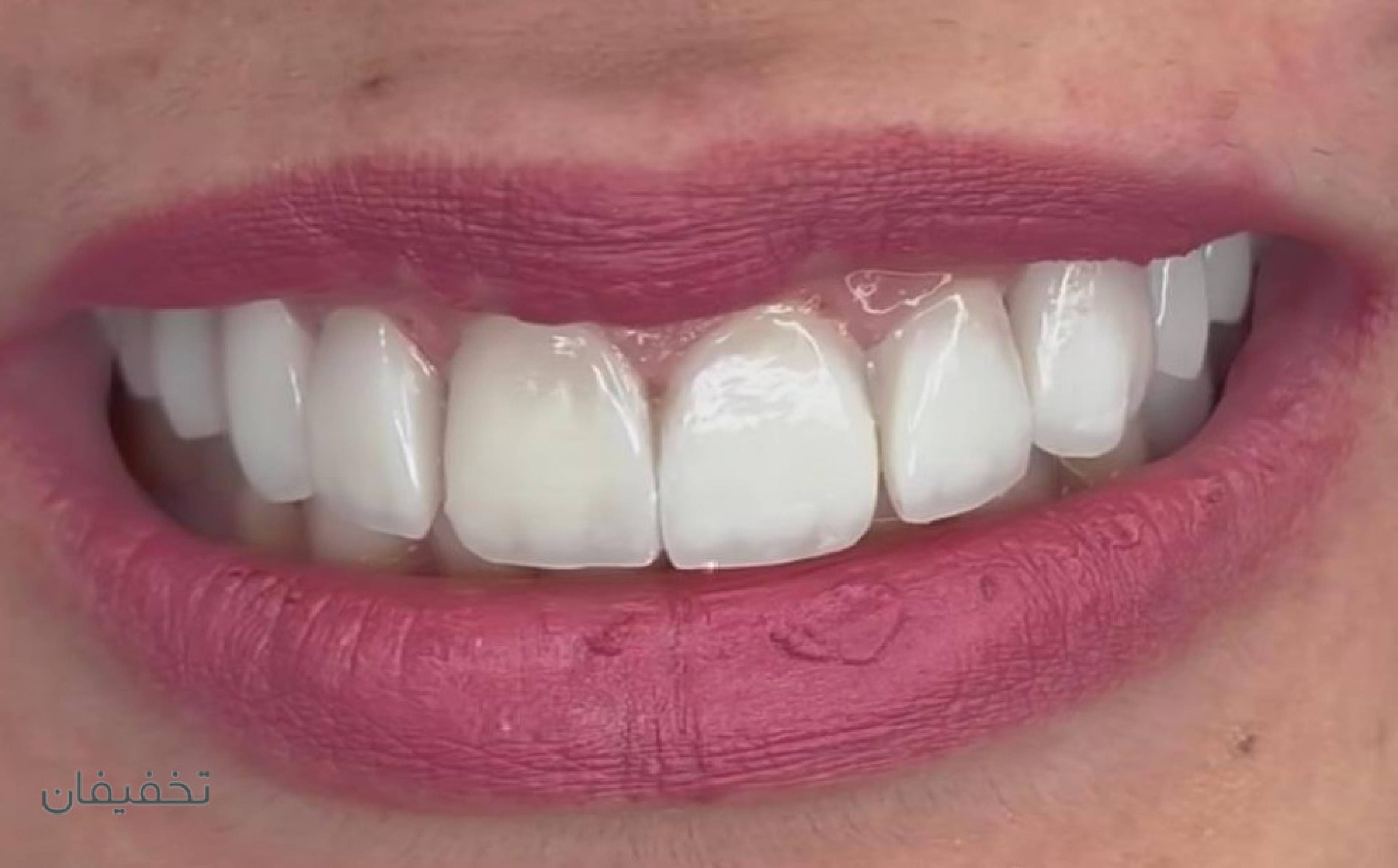 مطب دندانپزشکی دکتر میرمحمدی(دنتال ام دی)