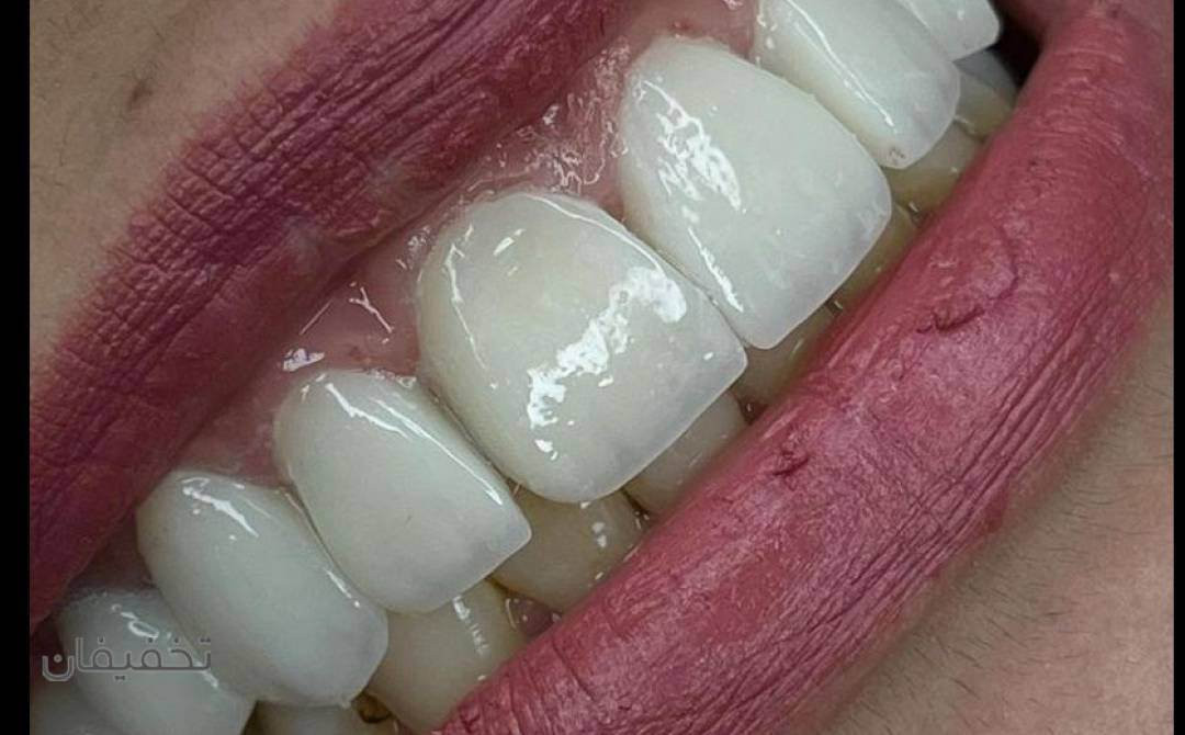 مطب دندانپزشکی دکتر میرمحمدی(دنتال ام دی)