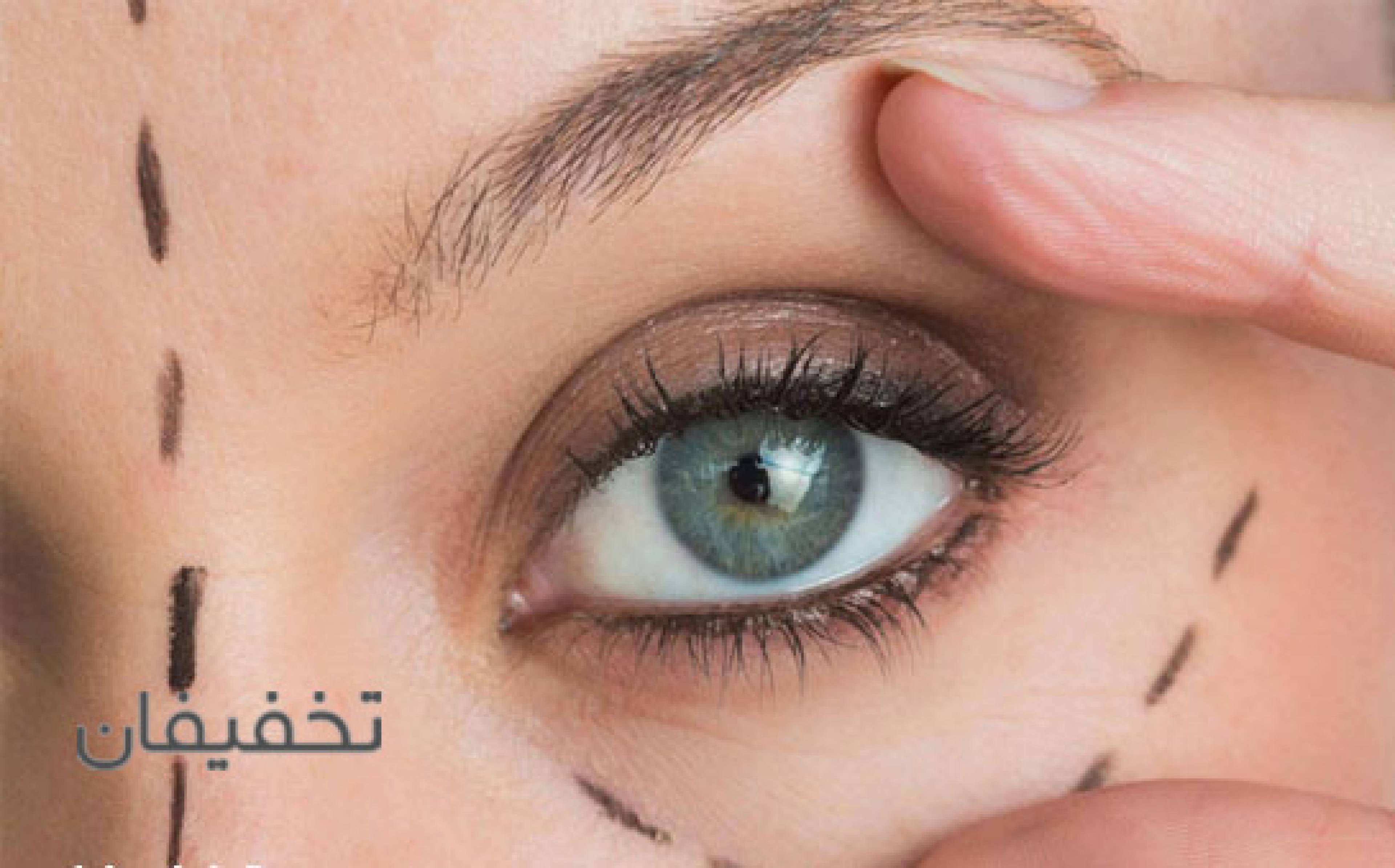 مرکز تخصصی جراحی پلک RMC