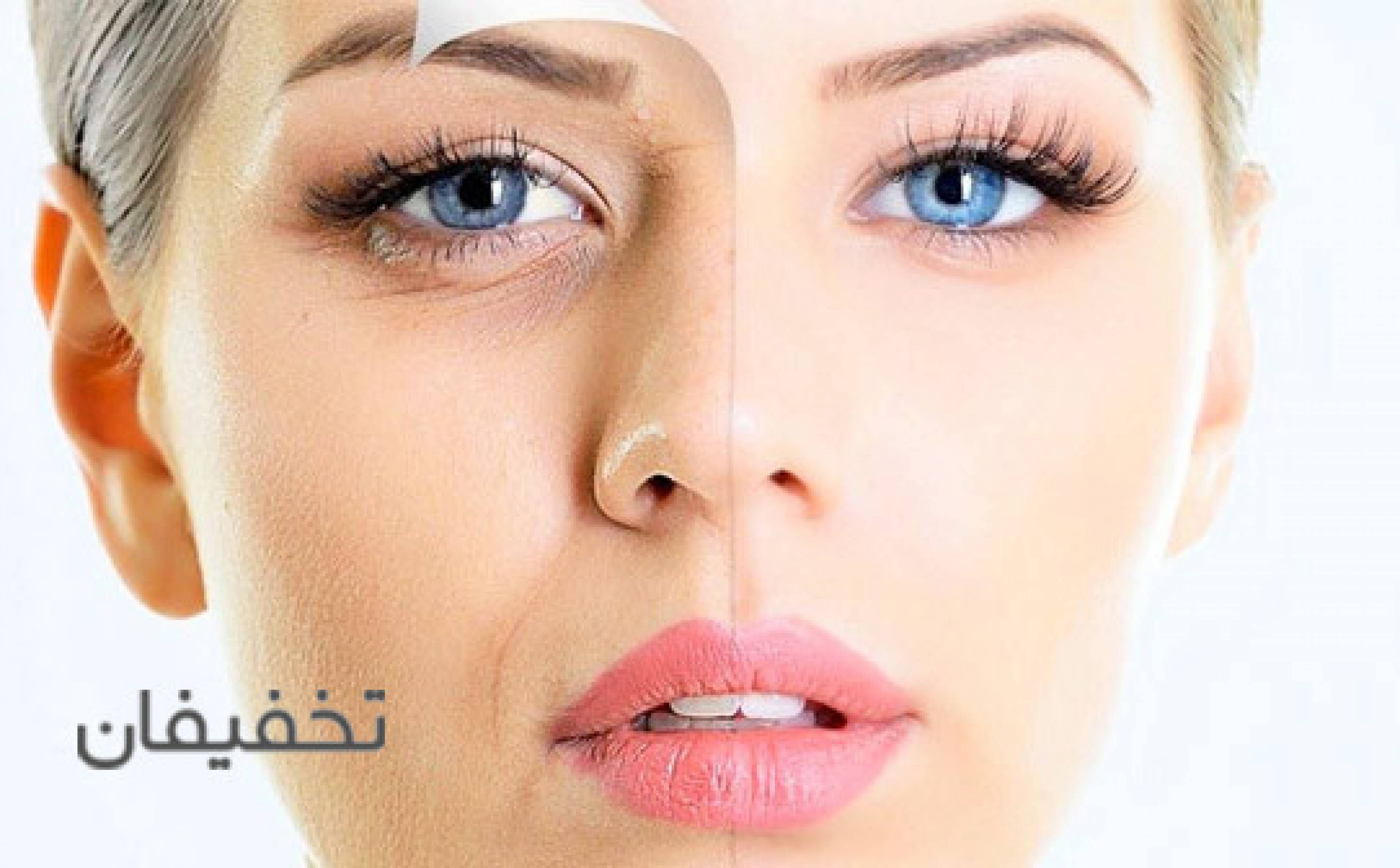 مرکز تخصصی جراحی پلک RMC