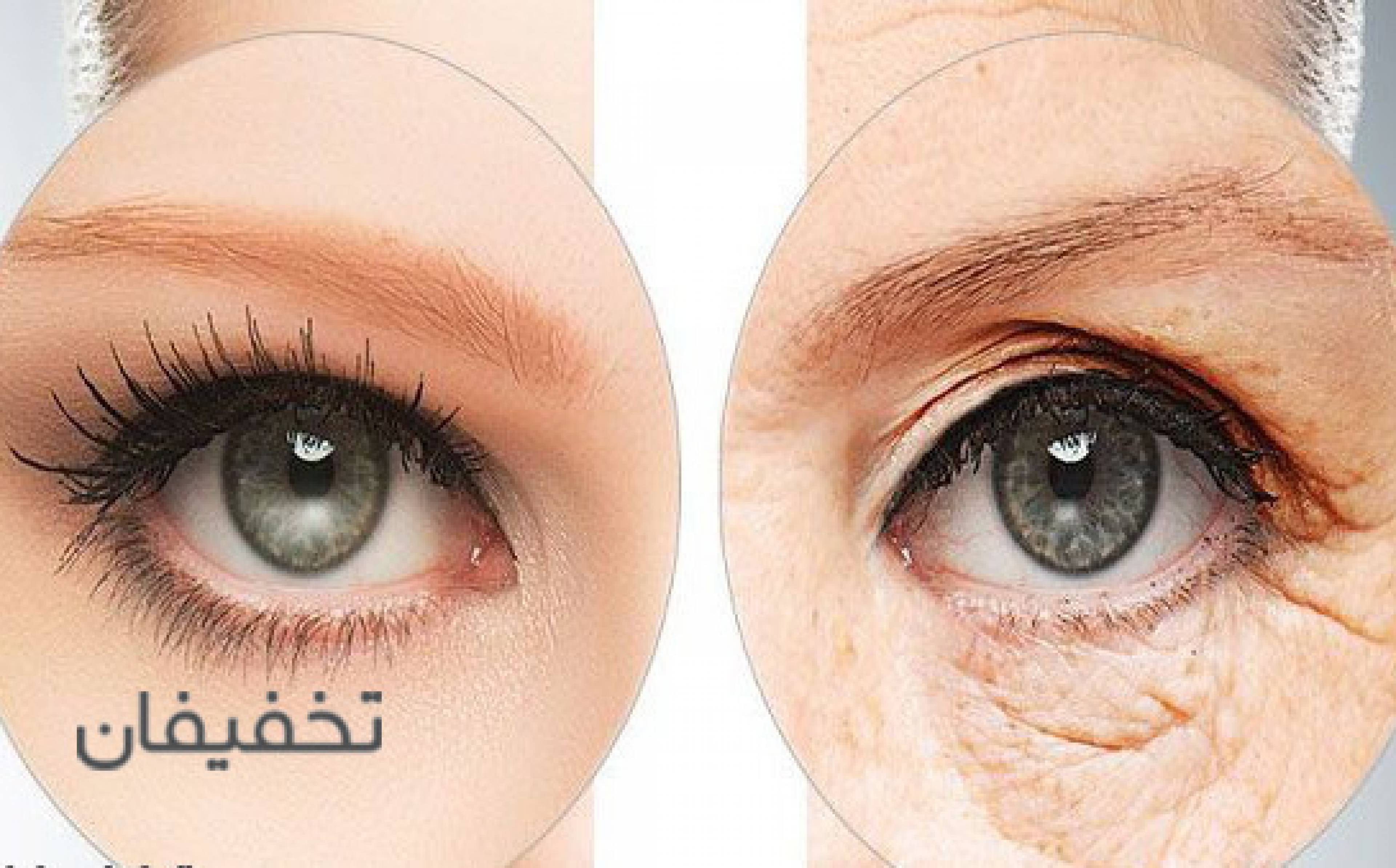 مرکز تخصصی جراحی پلک RMC