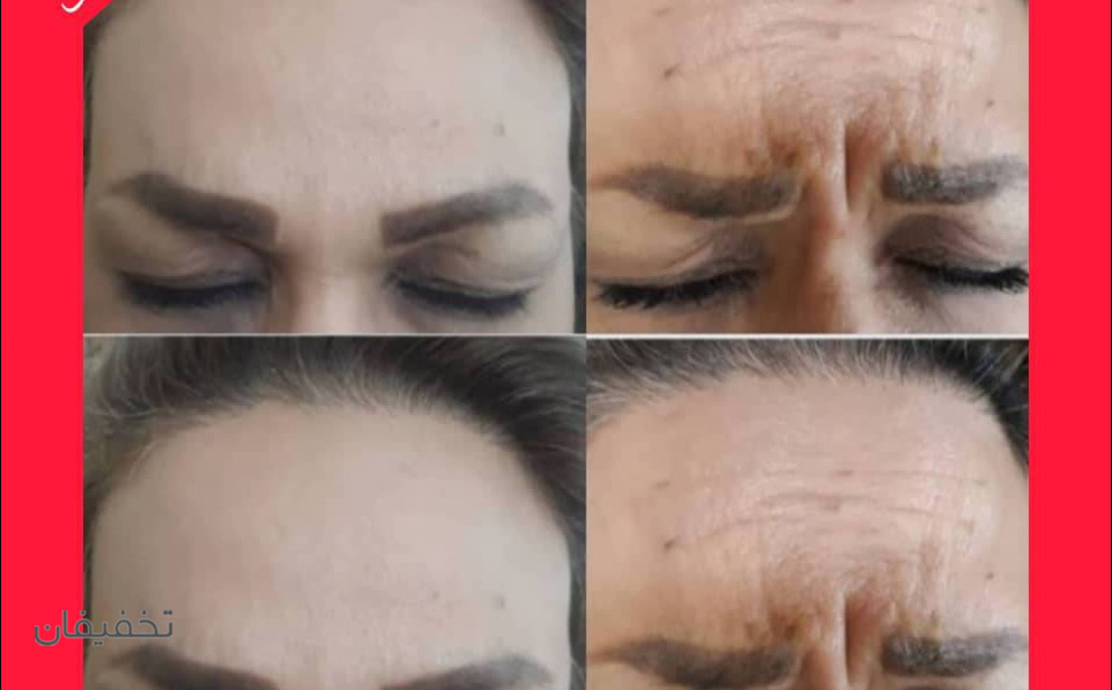 مرکز پوست مو زیبایی آناهیتا