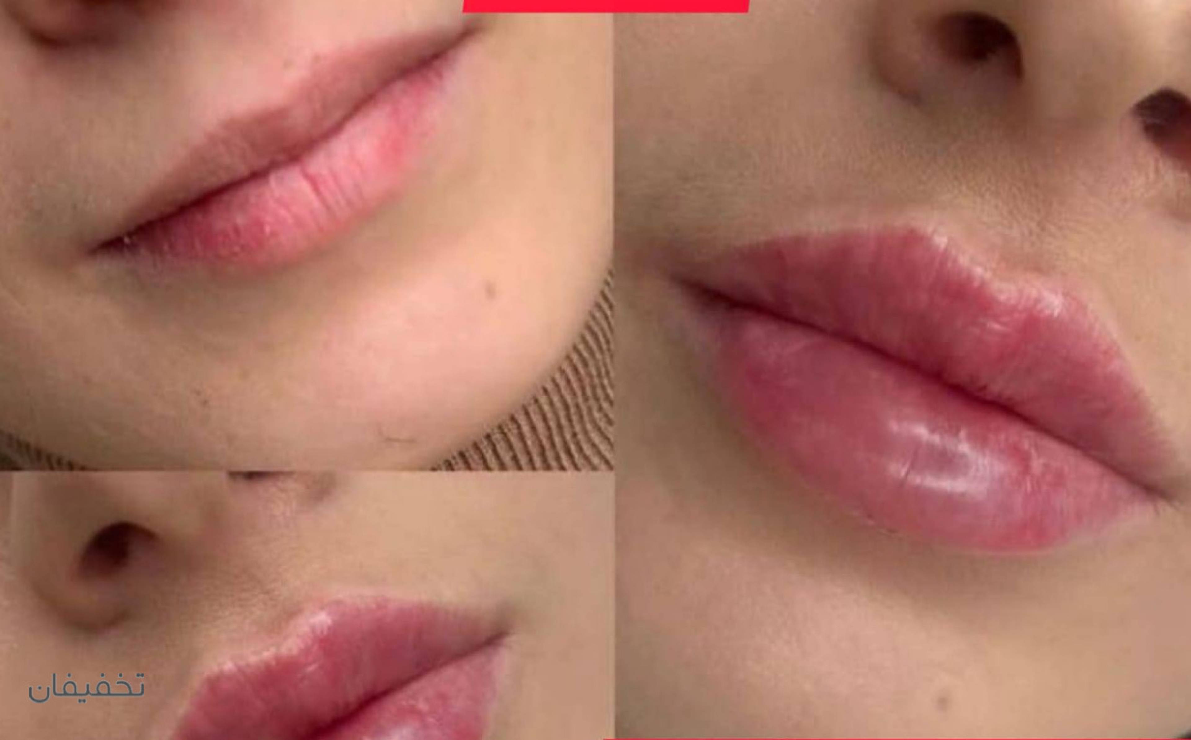 مرکز پوست مو زیبایی آناهیتا