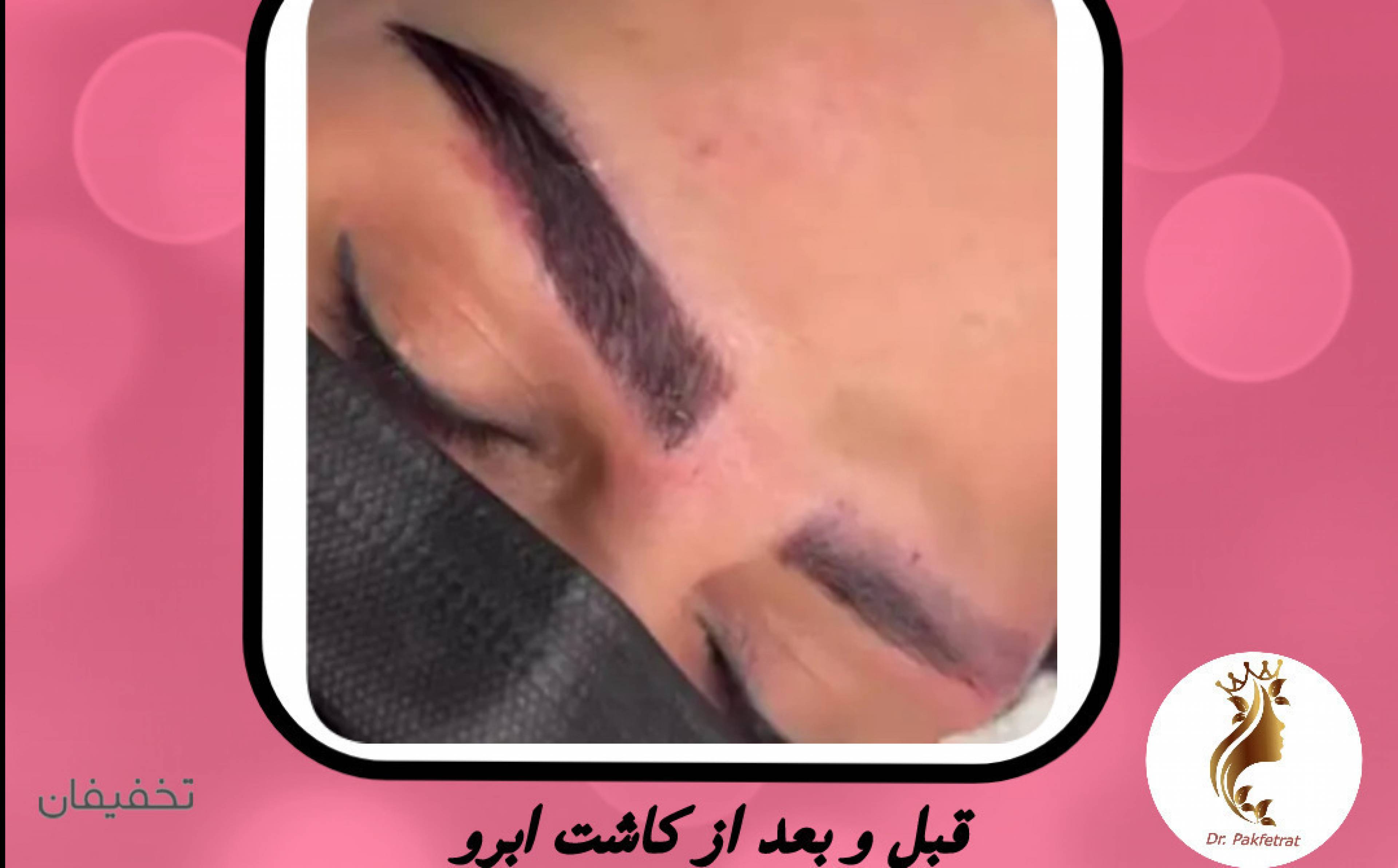 مرکز پوست مو زیبایی آناهیتا
