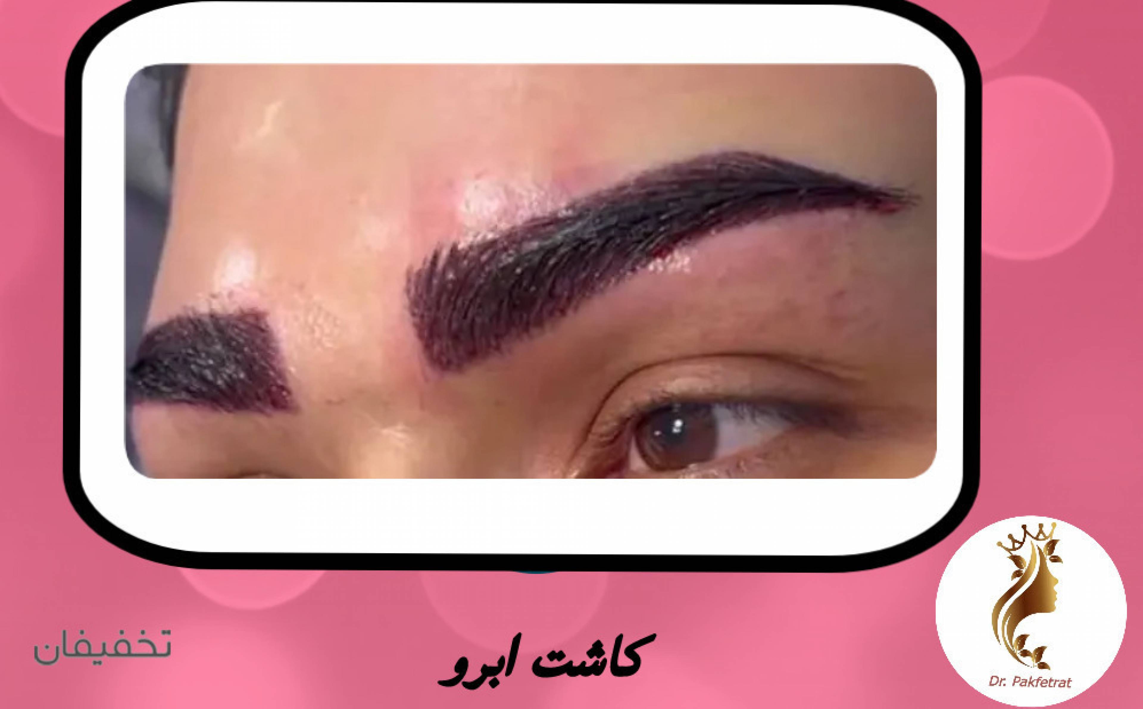 مرکز پوست مو زیبایی آناهیتا