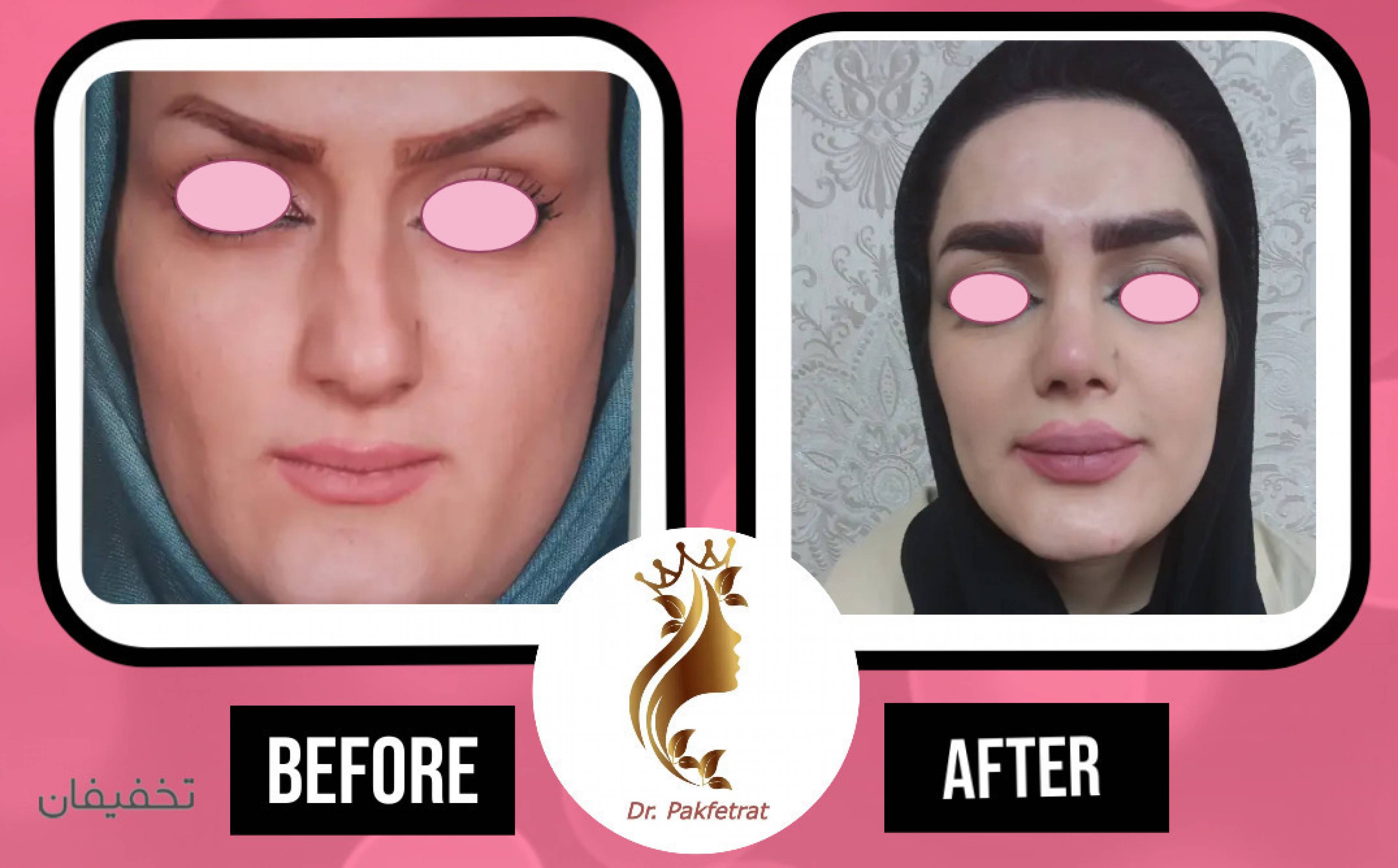 مرکز پوست مو زیبایی آناهیتا