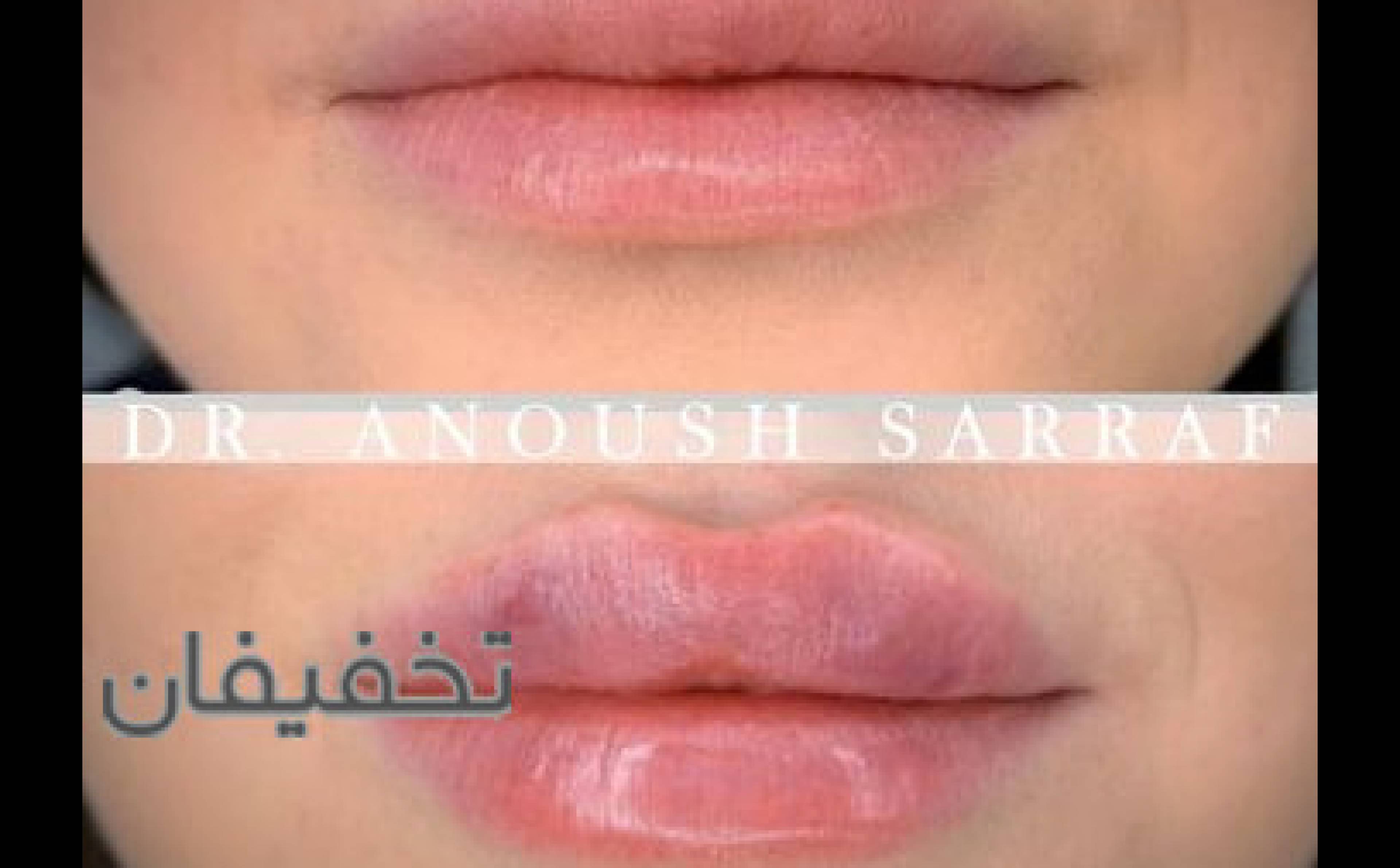 مطب پوست، مو و زیبایی دکتر صراف
