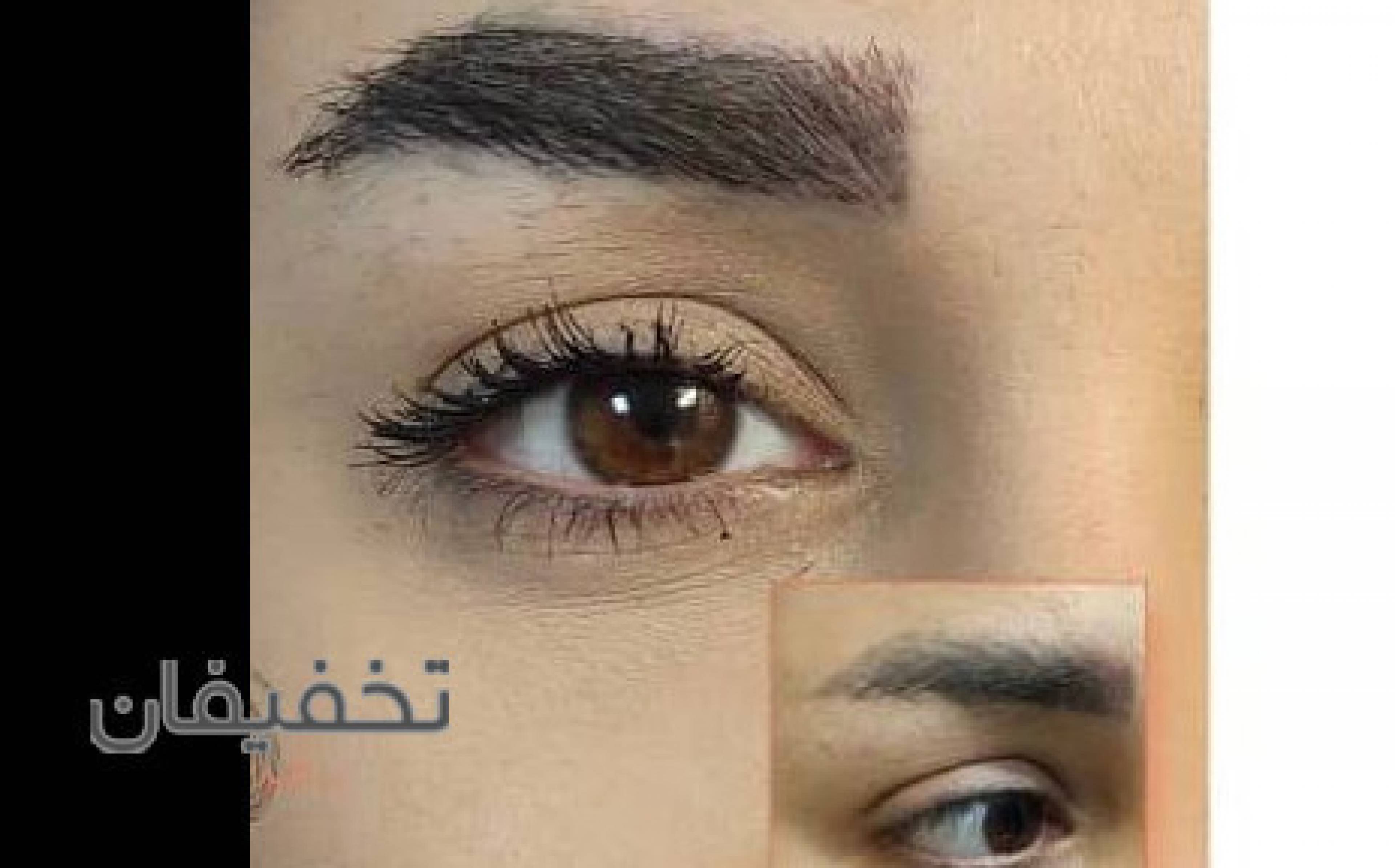کاشت ابرو و مو