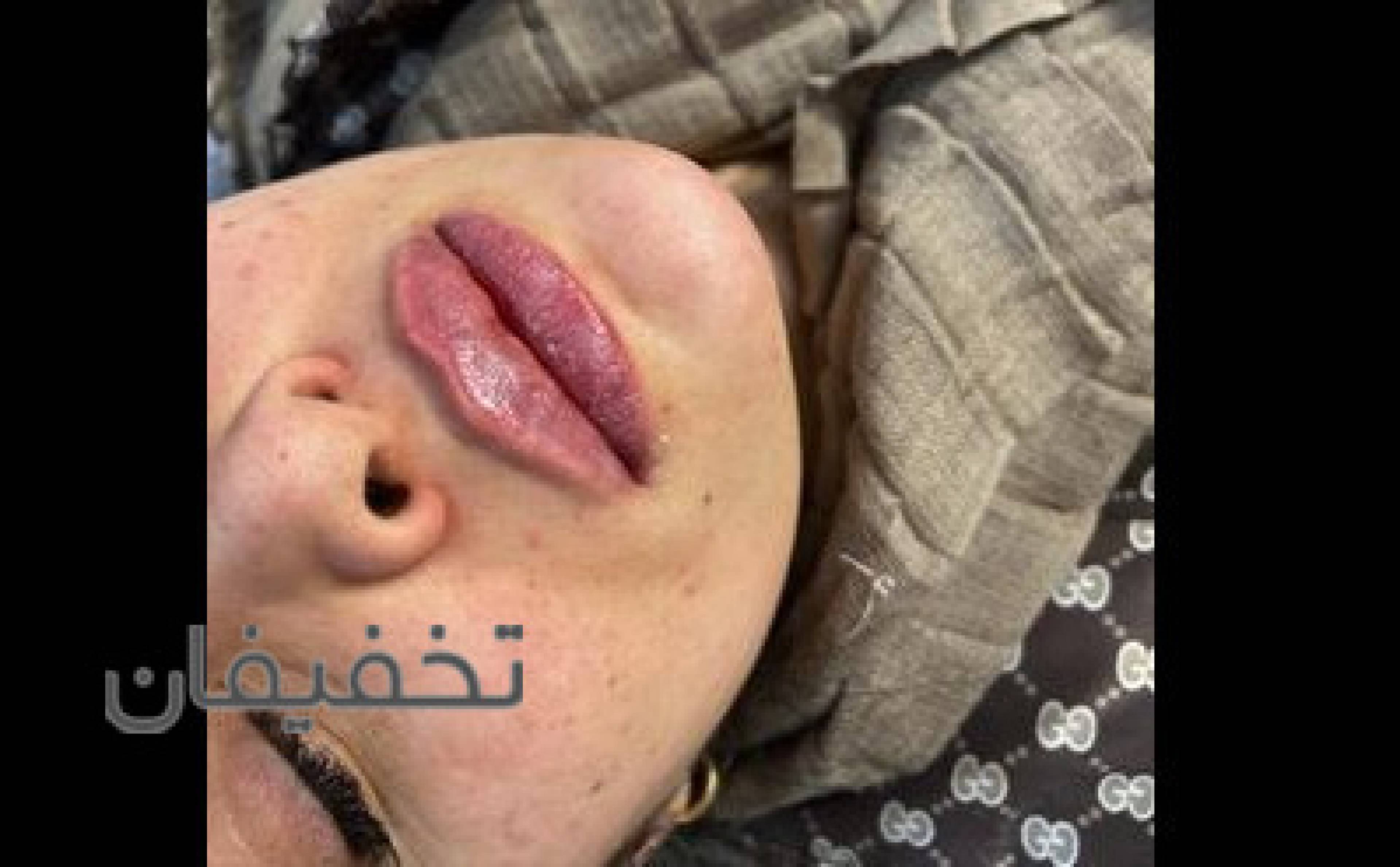 کلینیک تخصصی زیبایی دکتر زانیار فتحی 