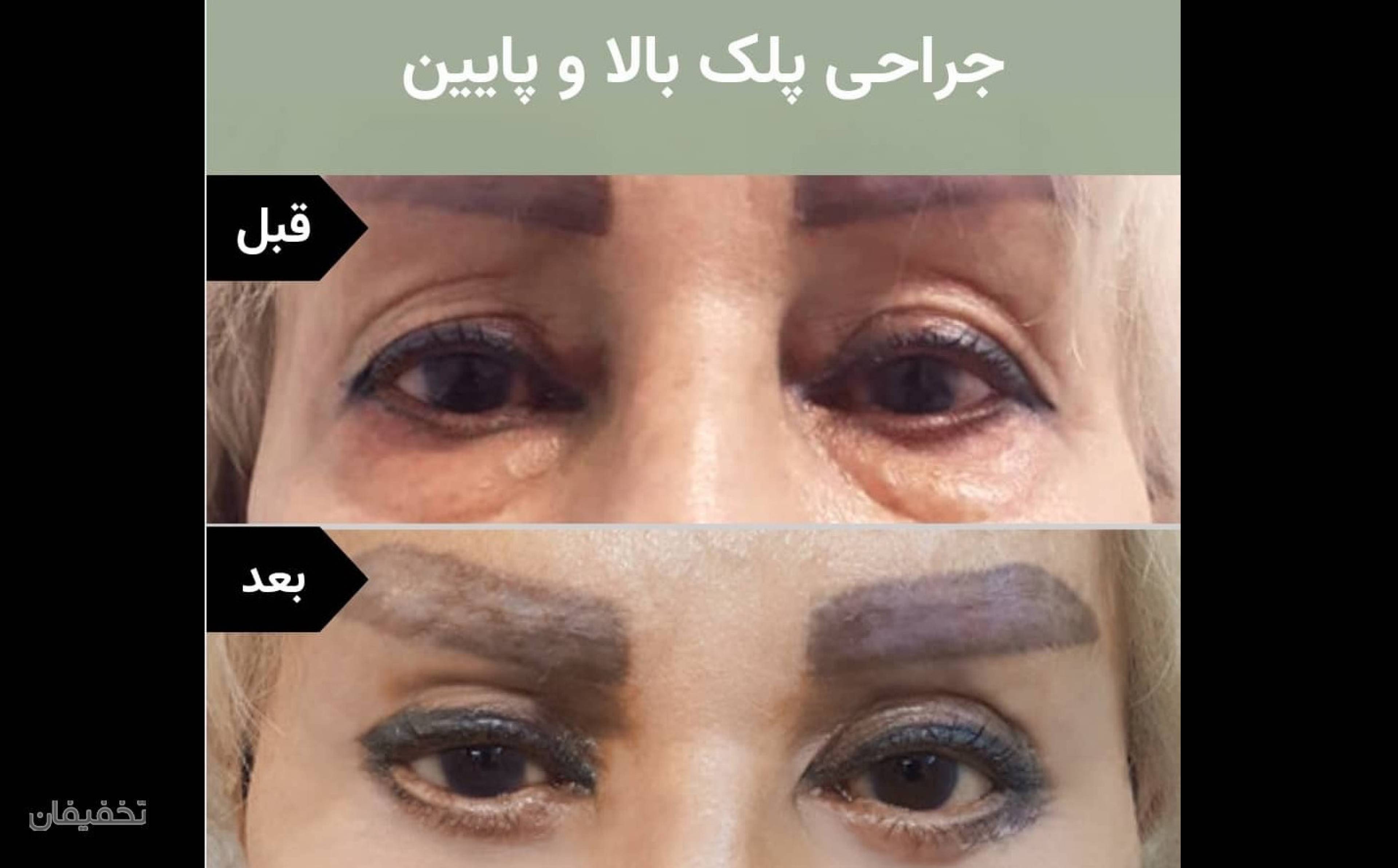 مطب زیبایی دکتر غفوریان