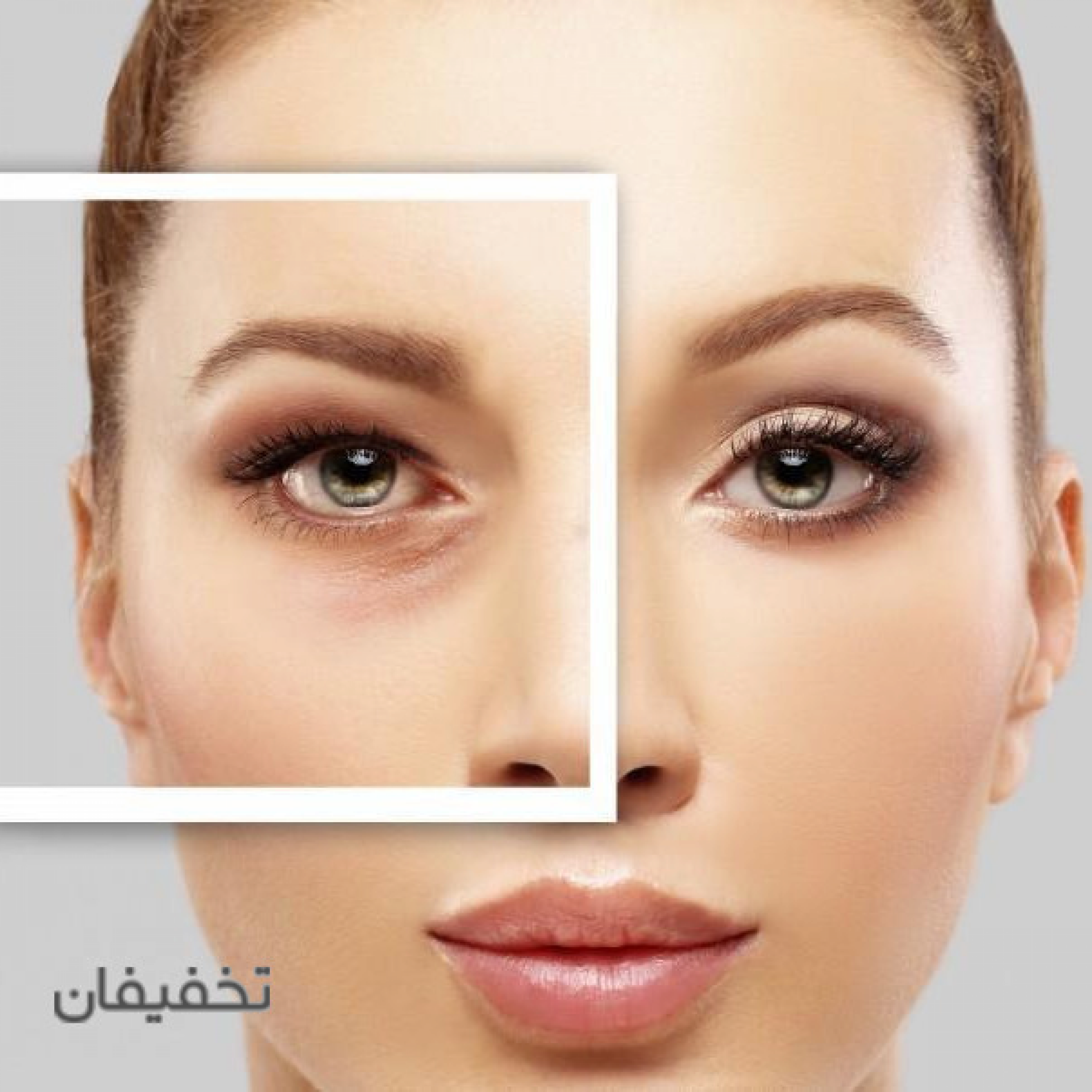 مطب زیبایی دکتر غفوریان