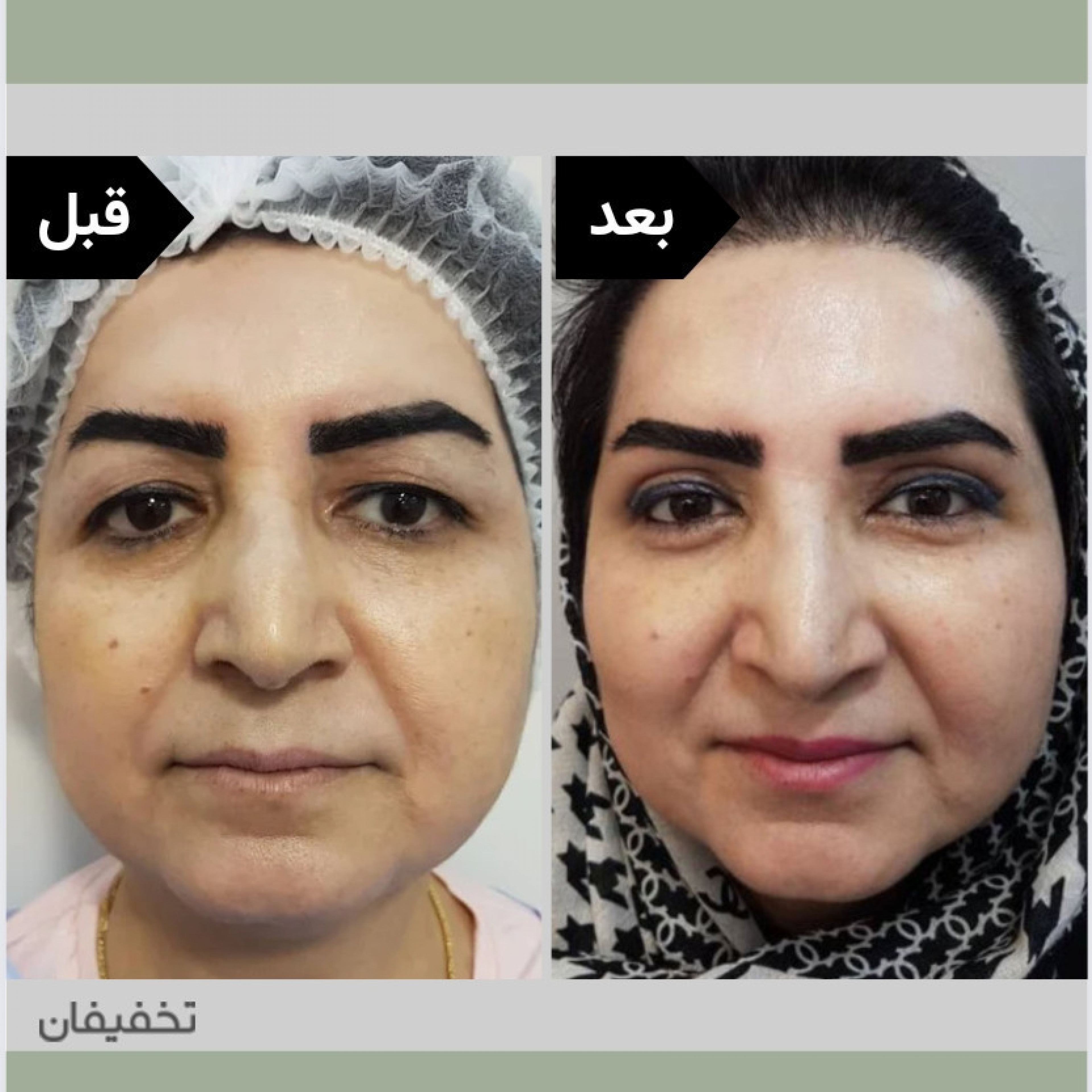 مطب زیبایی دکتر غفوریان