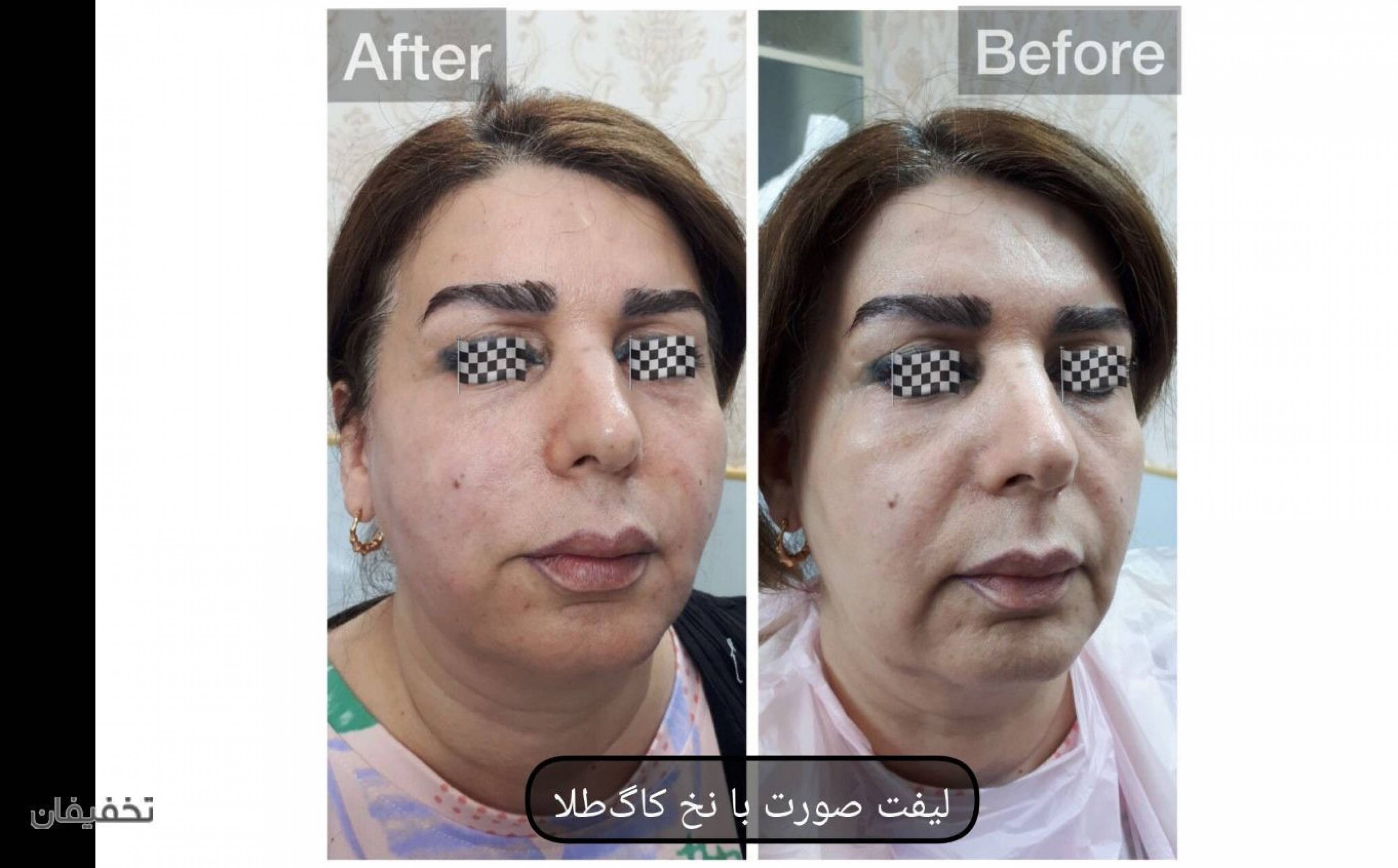 مرکز پوست و مو و زیبایی دالیا