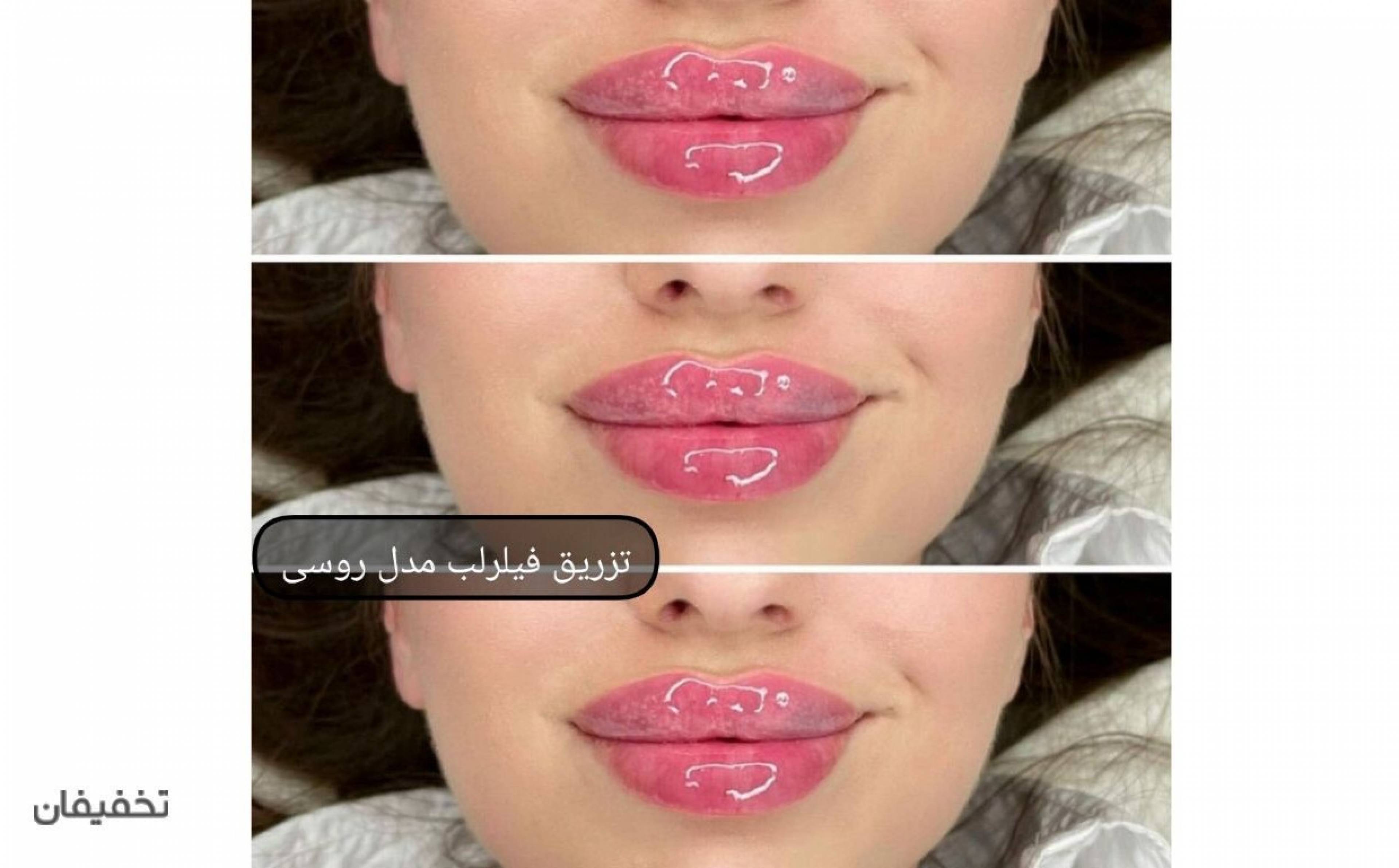 مرکز پوست و مو و زیبایی دالیا