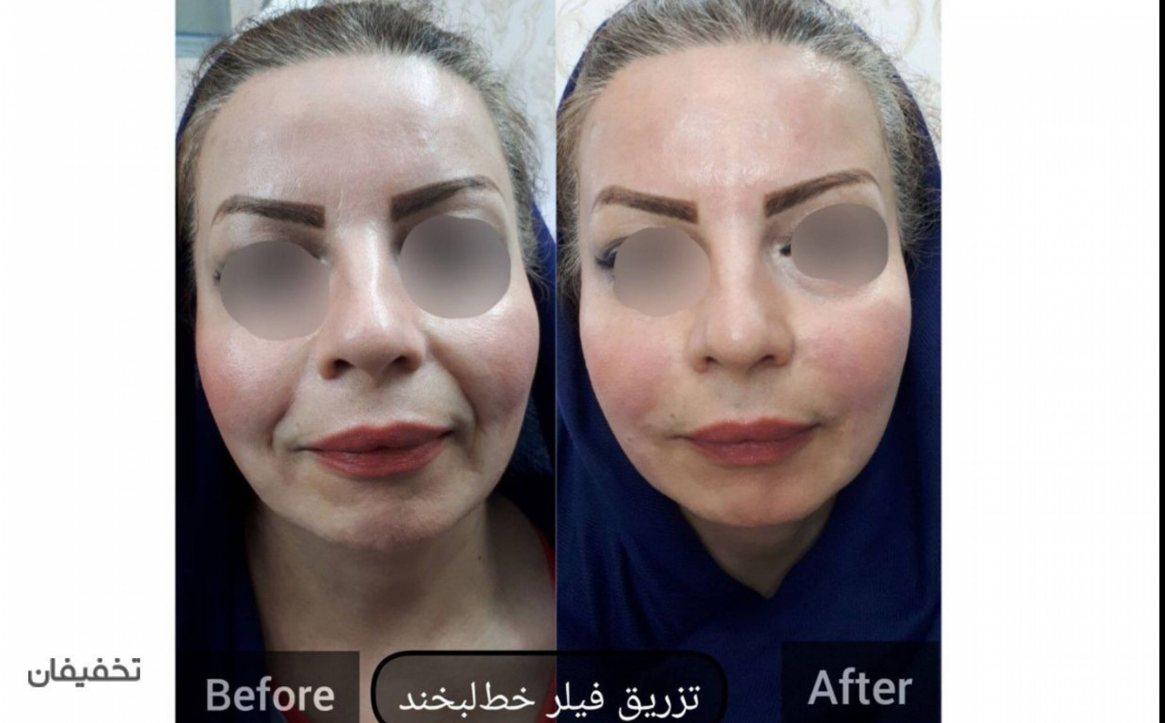 مرکز پوست و مو و زیبایی دالیا