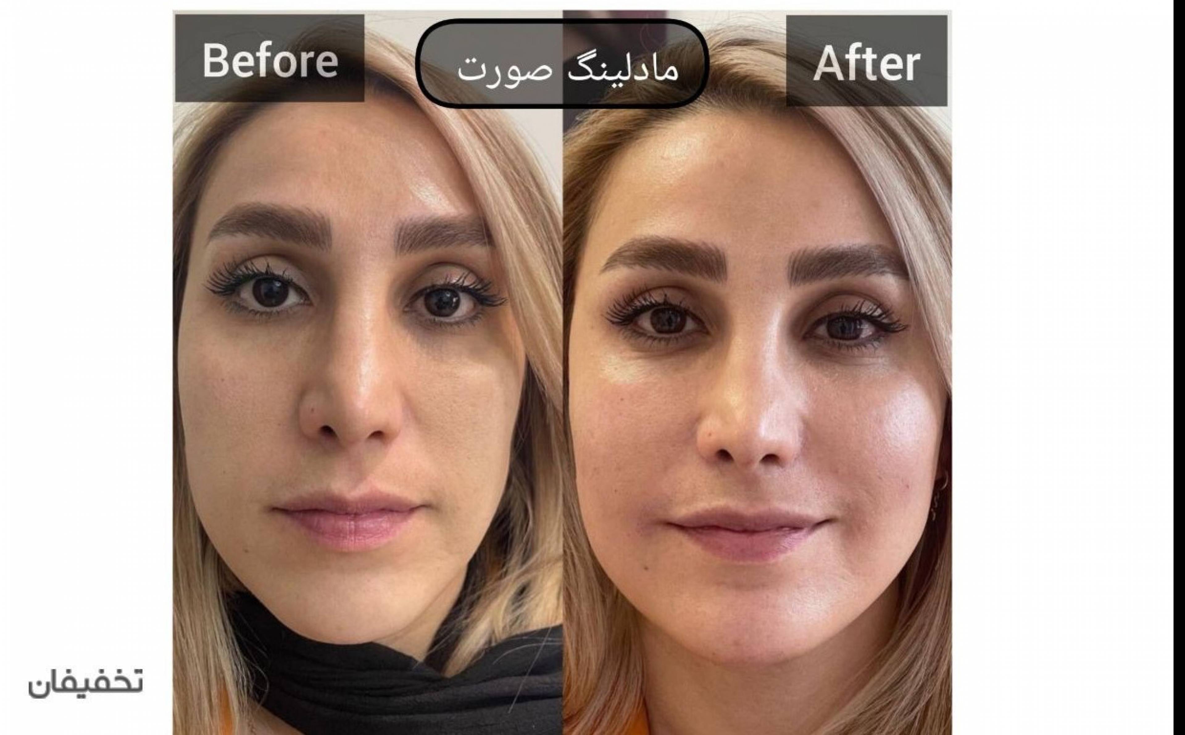 مرکز پوست و مو و زیبایی دالیا