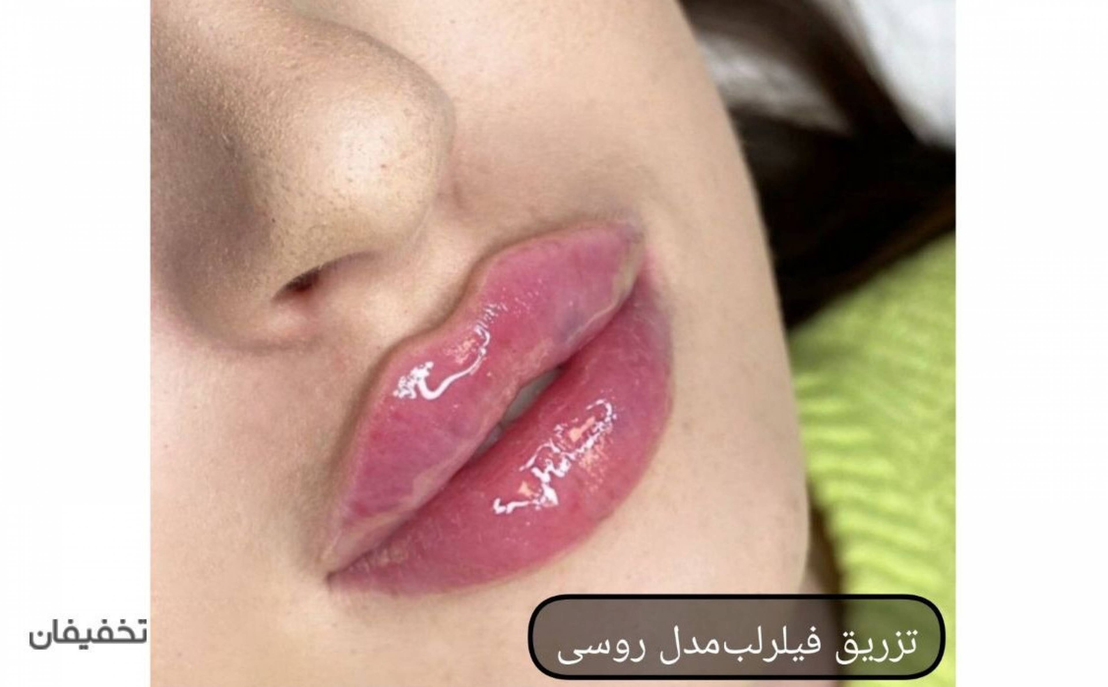 مرکز پوست و مو و زیبایی دالیا