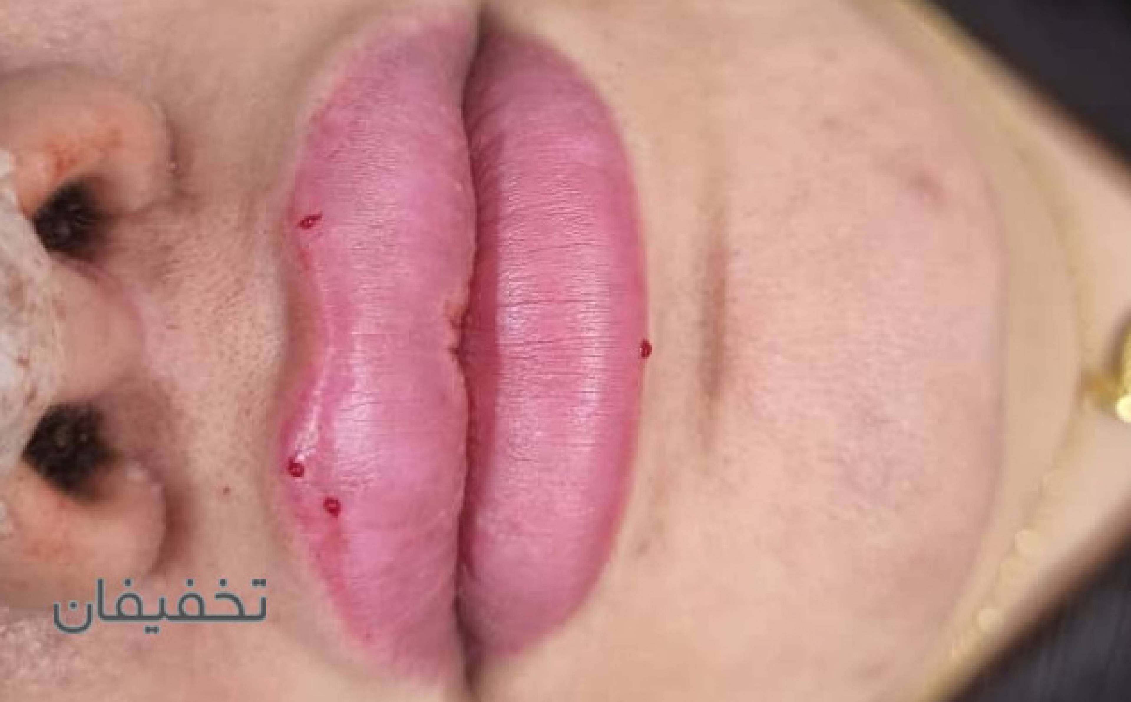مرکز پوست و مو و لاغری آبانگاه سلامت سبز