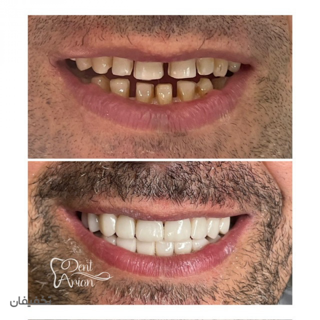مركز دندانپزشكى دنت آرين