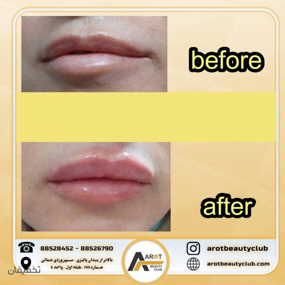 مطب لاغری و زیبایی آروت بیوتی 