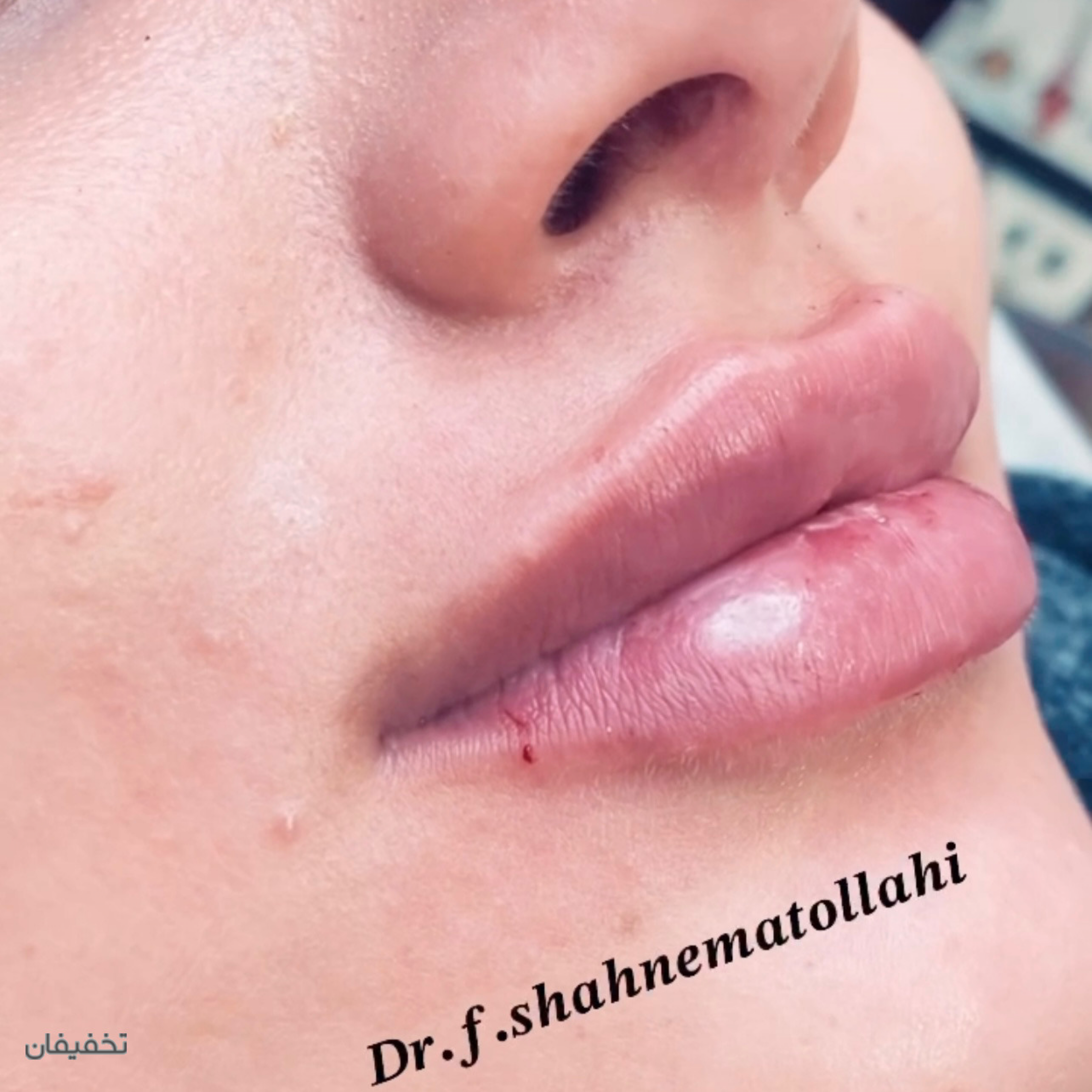 مطب پوست، مو و زيبايی خانم دكتر شاه نعمت الهی