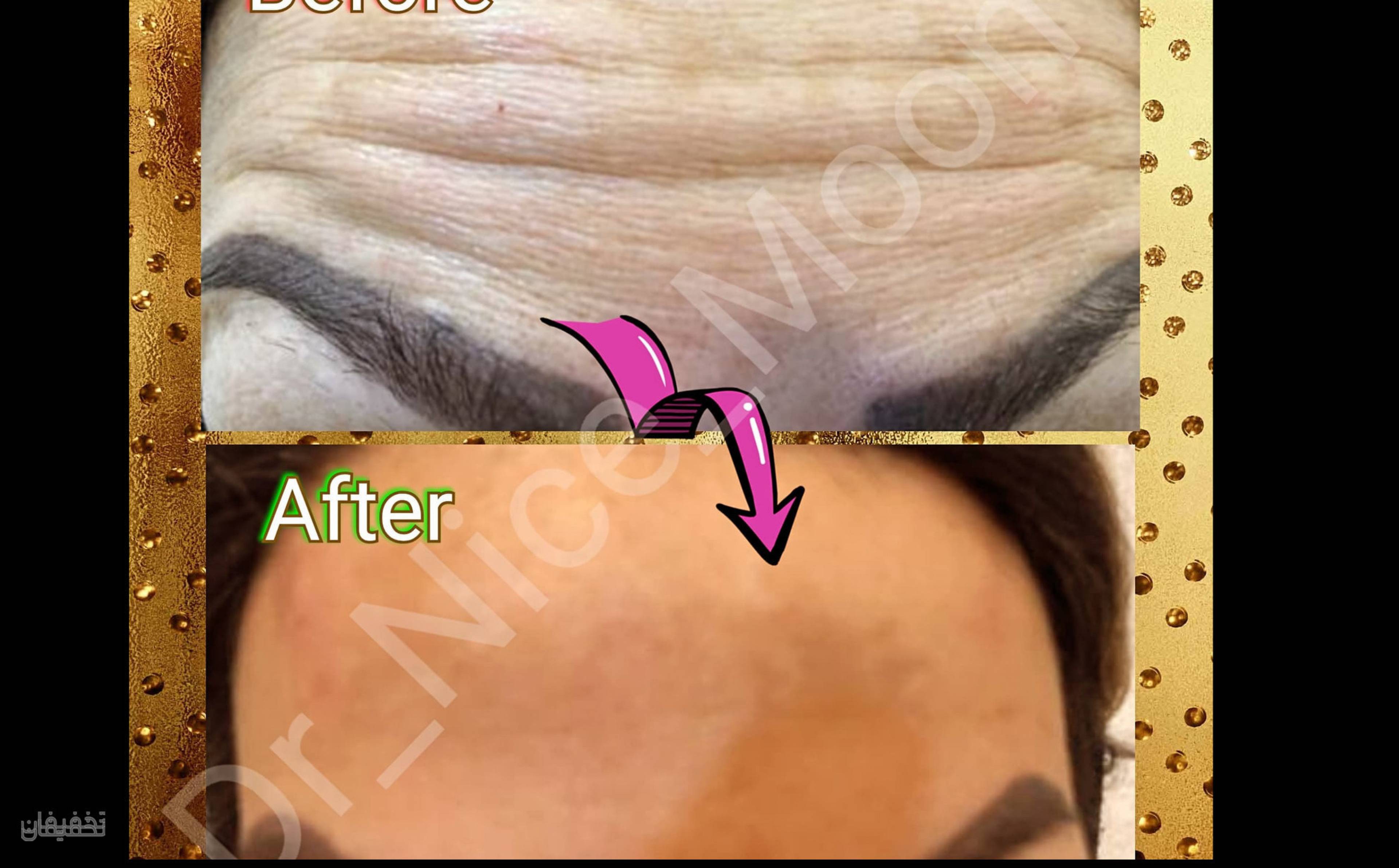 مطب زیبایی ماه